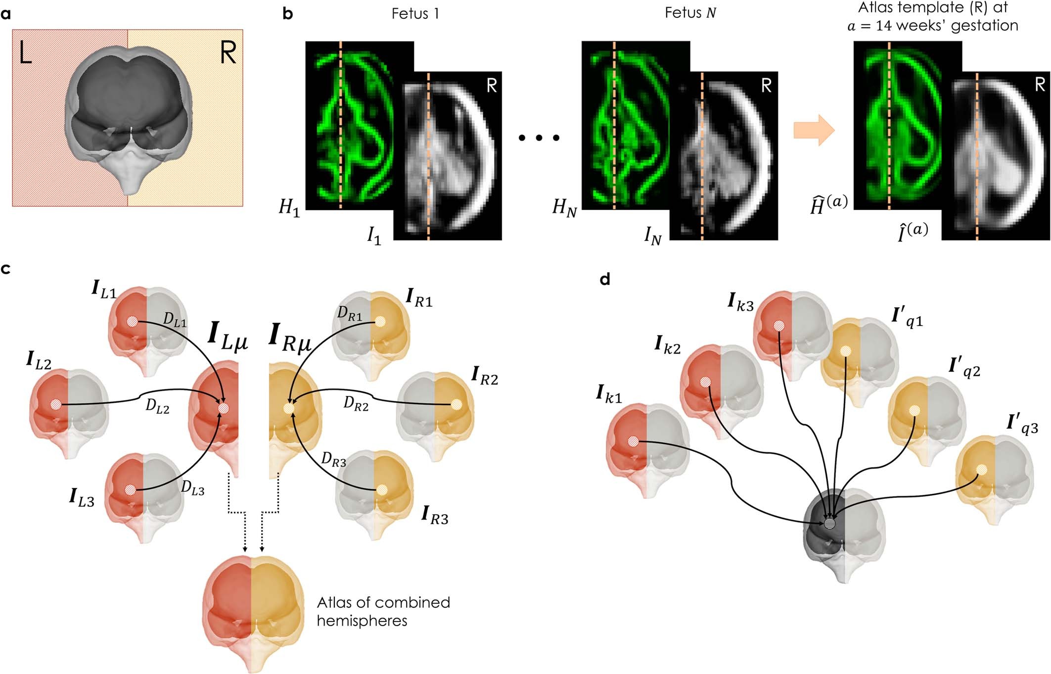 Extended Data Fig. 5: Image data preprocessing for atlas construction and statistical analysis. The image processing steps are shown only for the right hemisphere, but the same process was carried out for the left hemisphere.