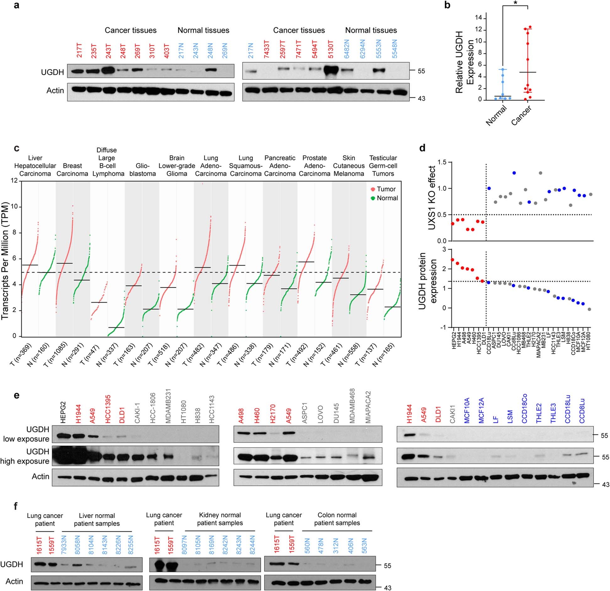 Extended Data Fig. 9: UGDH is elevated in cancer subsets.
