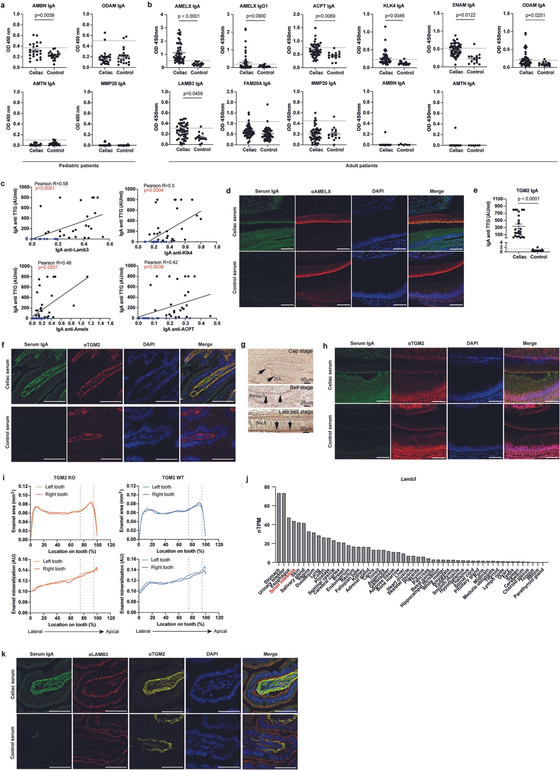 Extended Data Fig. 6: Patients with coeliac disease develop IgA autoantibodies to ameloblast-specific proteins and intestinal antigens.
