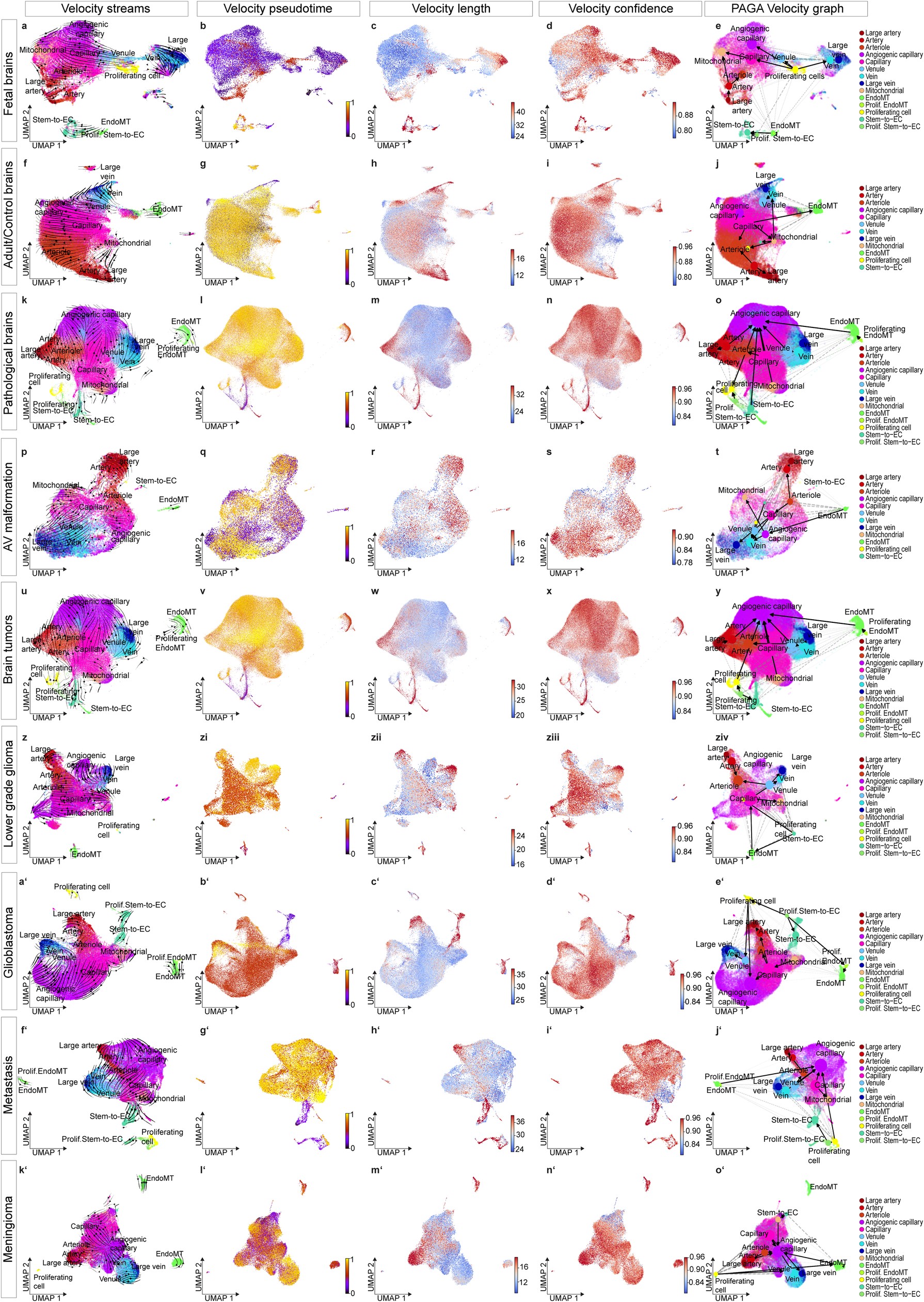 Extended Data Fig. 5: Trajectory analysis of fetal, adult and pathological human brain vascular ECs via RNA velocity along the AV-zonation/specification axis.