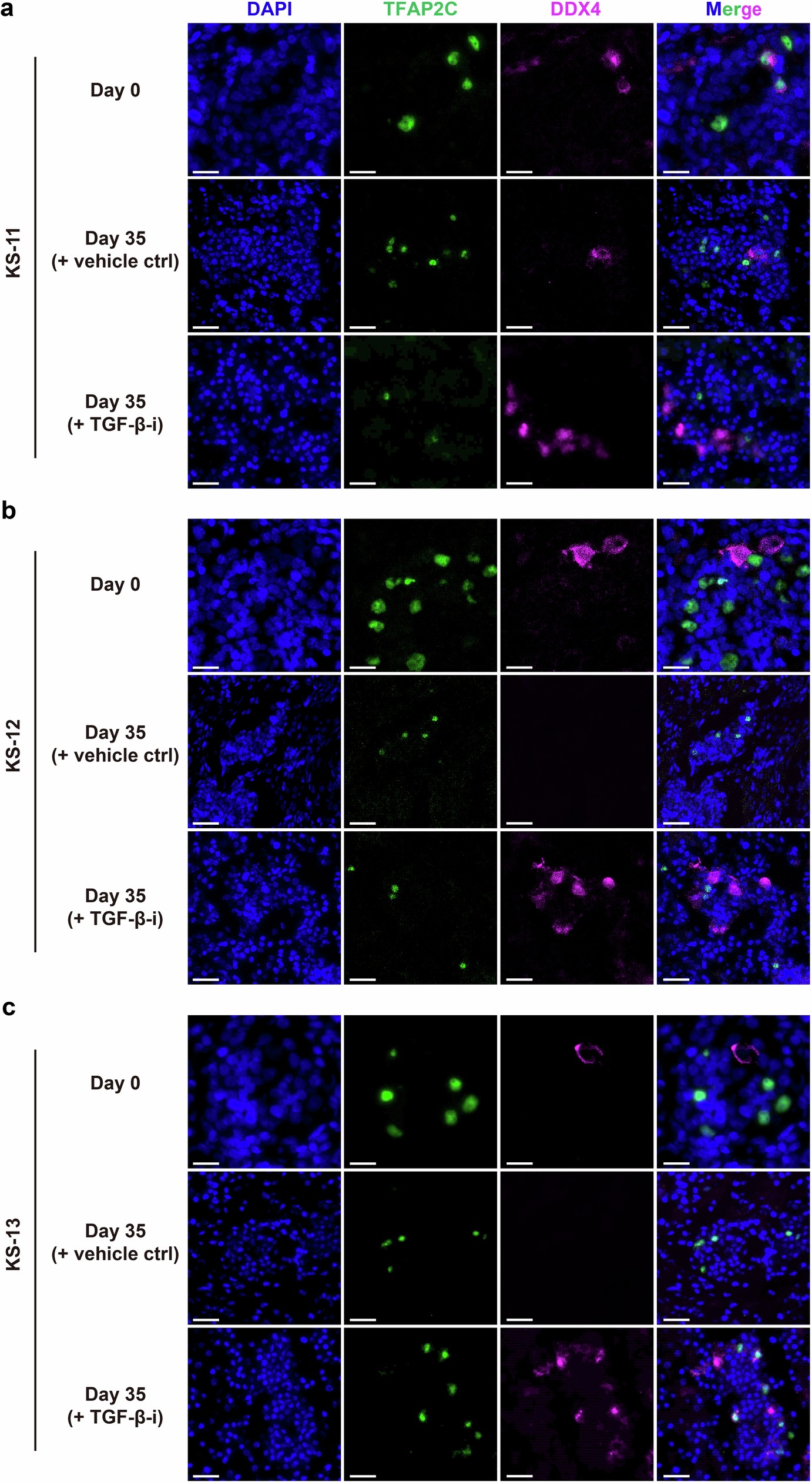 Extended Data Fig. 12: Images of uncultured and cultured fetal gonad tissues.
