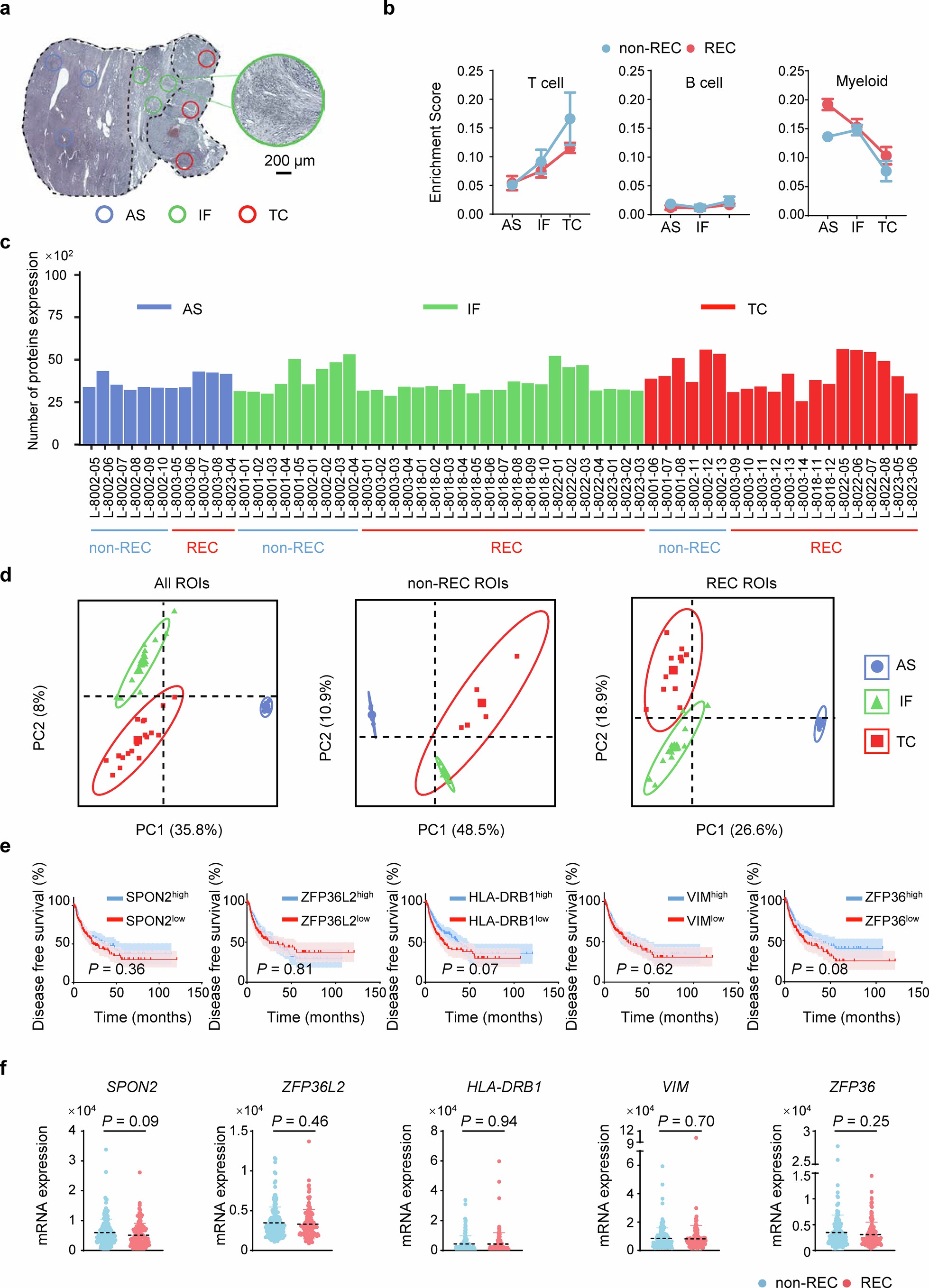Extended Data Fig. 2: Liquid Chromatography-Tandem Mass Spectrometry analysis of HCC tissue and prognosis analysis of HCC patients in TCGA database.