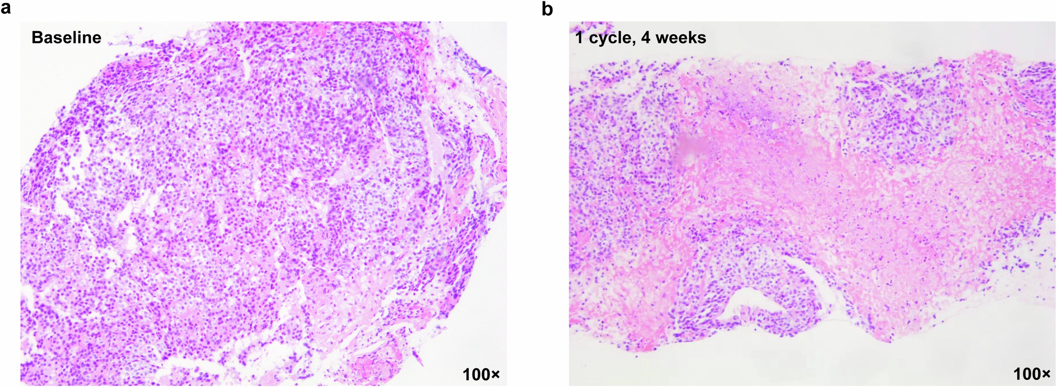 Extended Data Fig. 4: Pathological examination of patient no. A4-109 from Fig. 2.