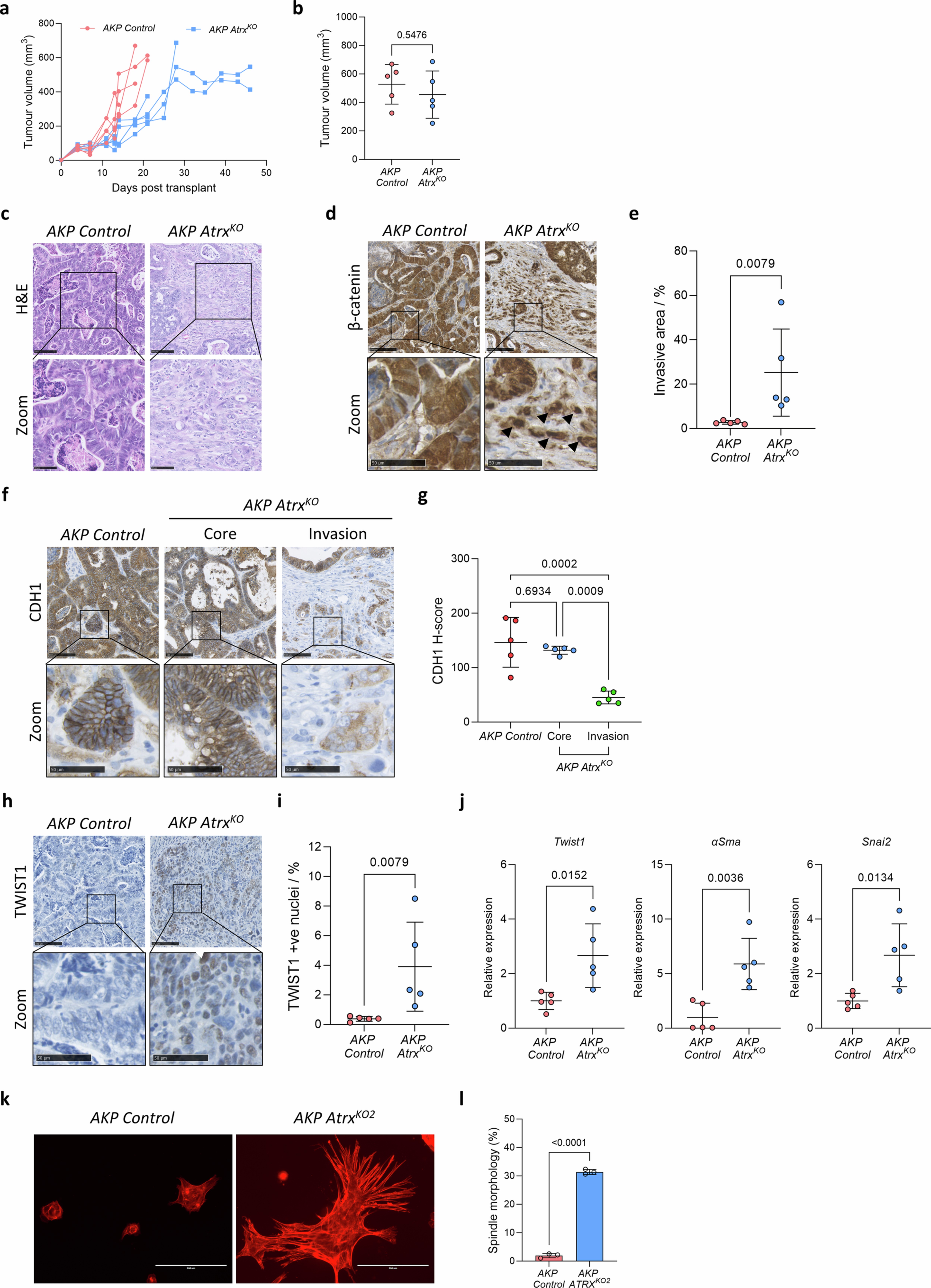 Extended Data Fig. 2: Atrx deletion leads to tumour invasion.
