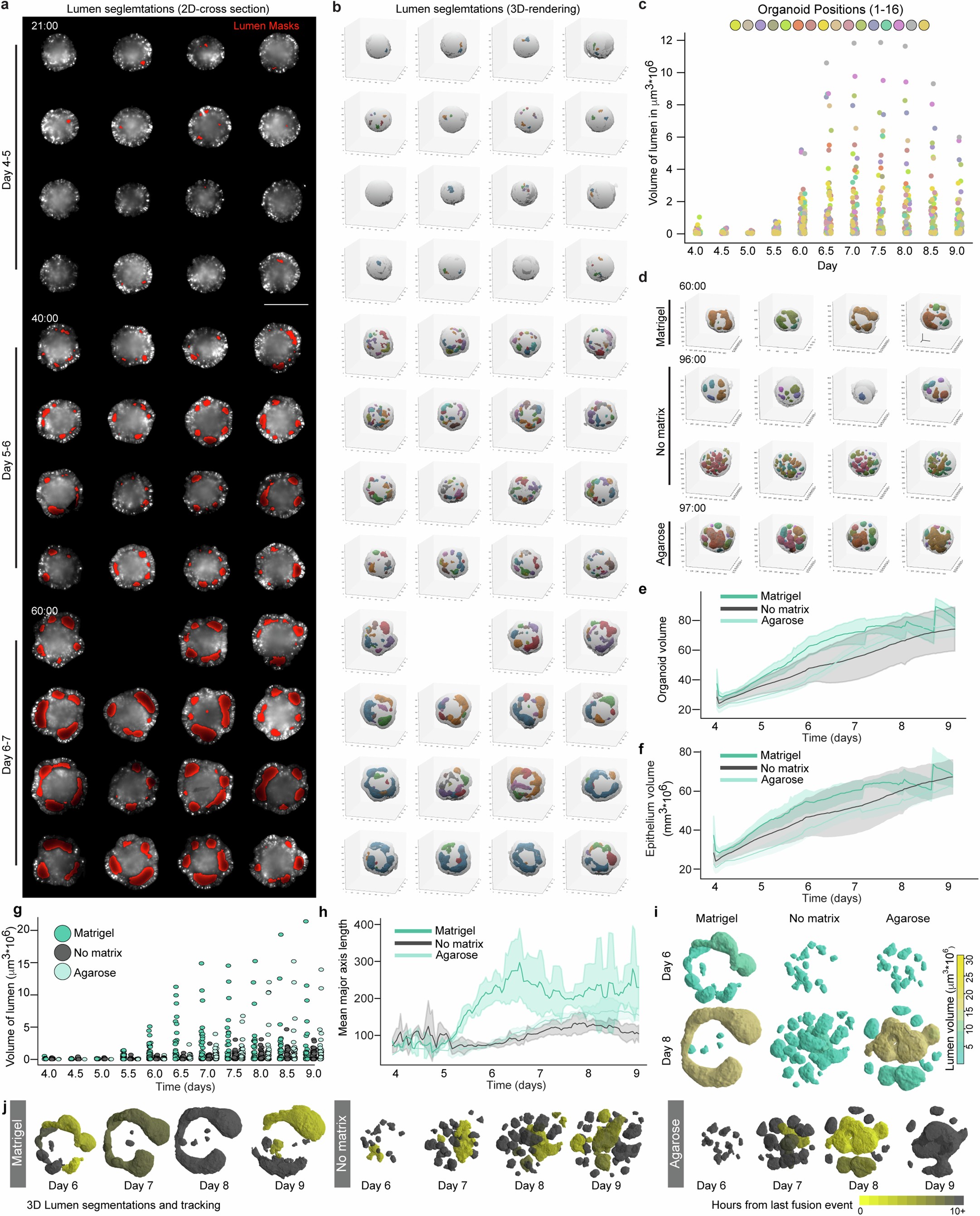 Extended Data Fig. 4: Lumen segmentations to track organoid and lumen morphodynamics in organoid development.