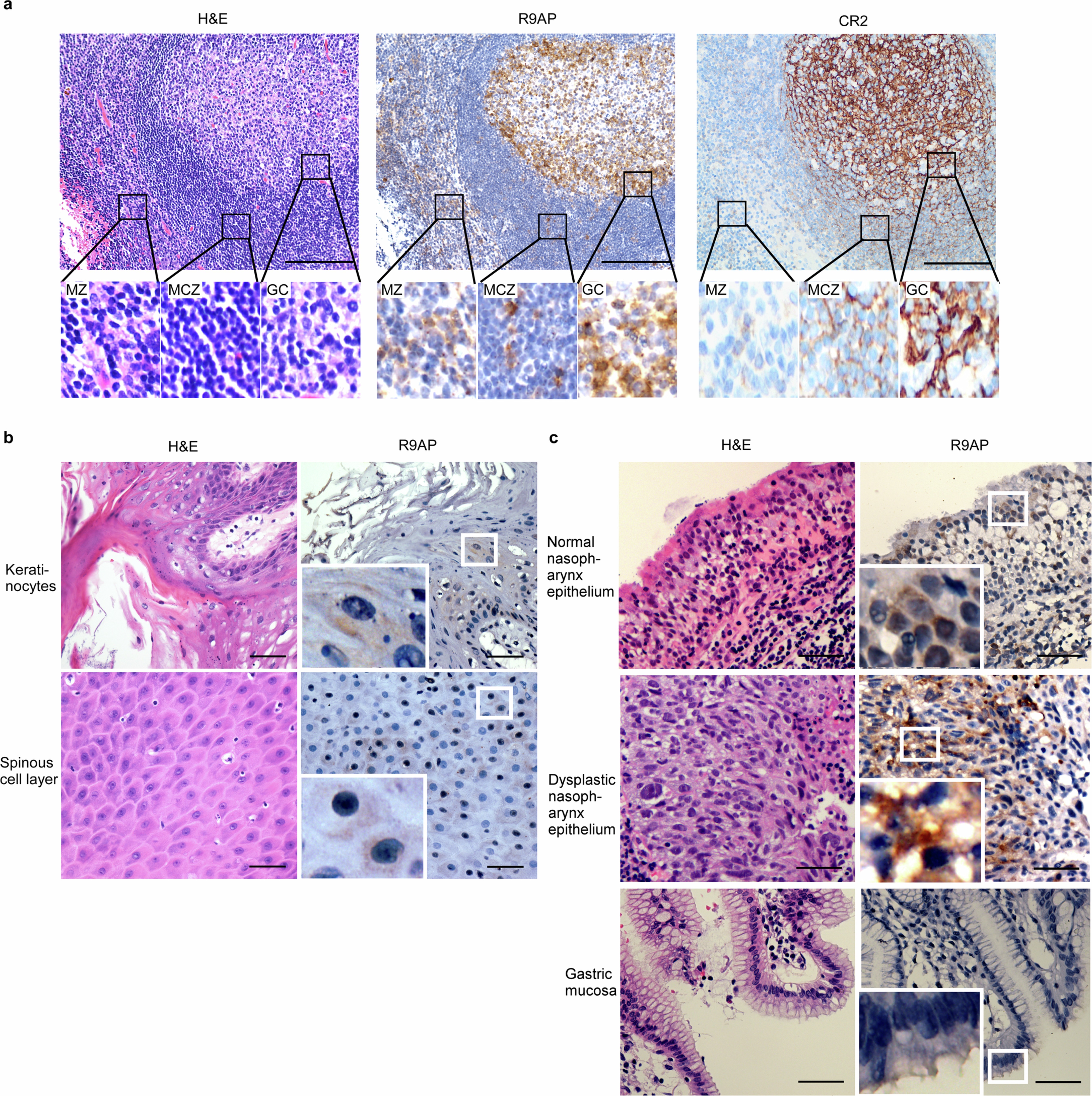 Extended Data Fig. 12: R9AP expression in human lymphoid, tongue, floor of mouth, nasopharynx epithelium and gastric mucosa tissues.