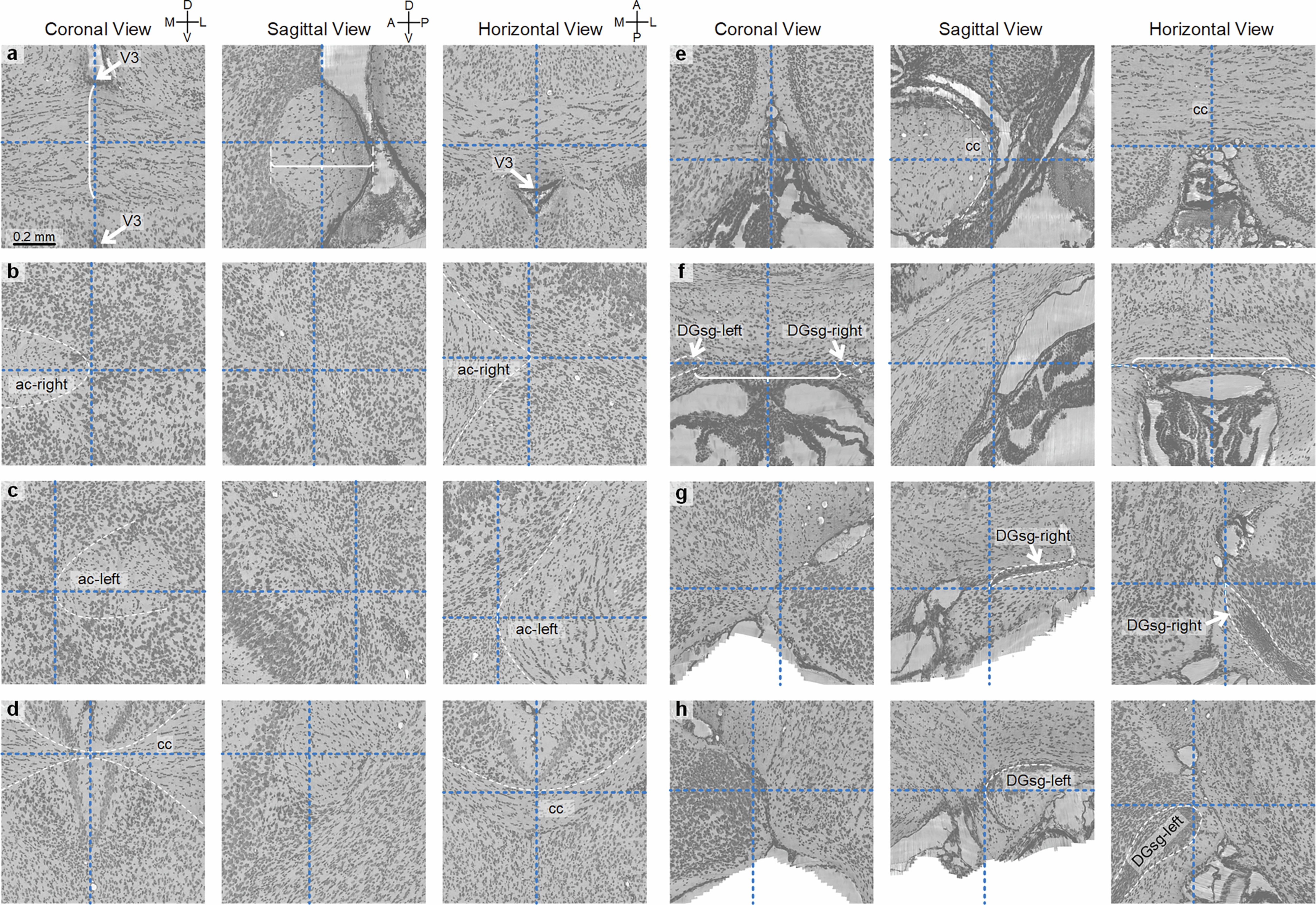 Extended Data Fig. 7: Cytoarchitectural criteria for defining intracranial datum marks of STAM.