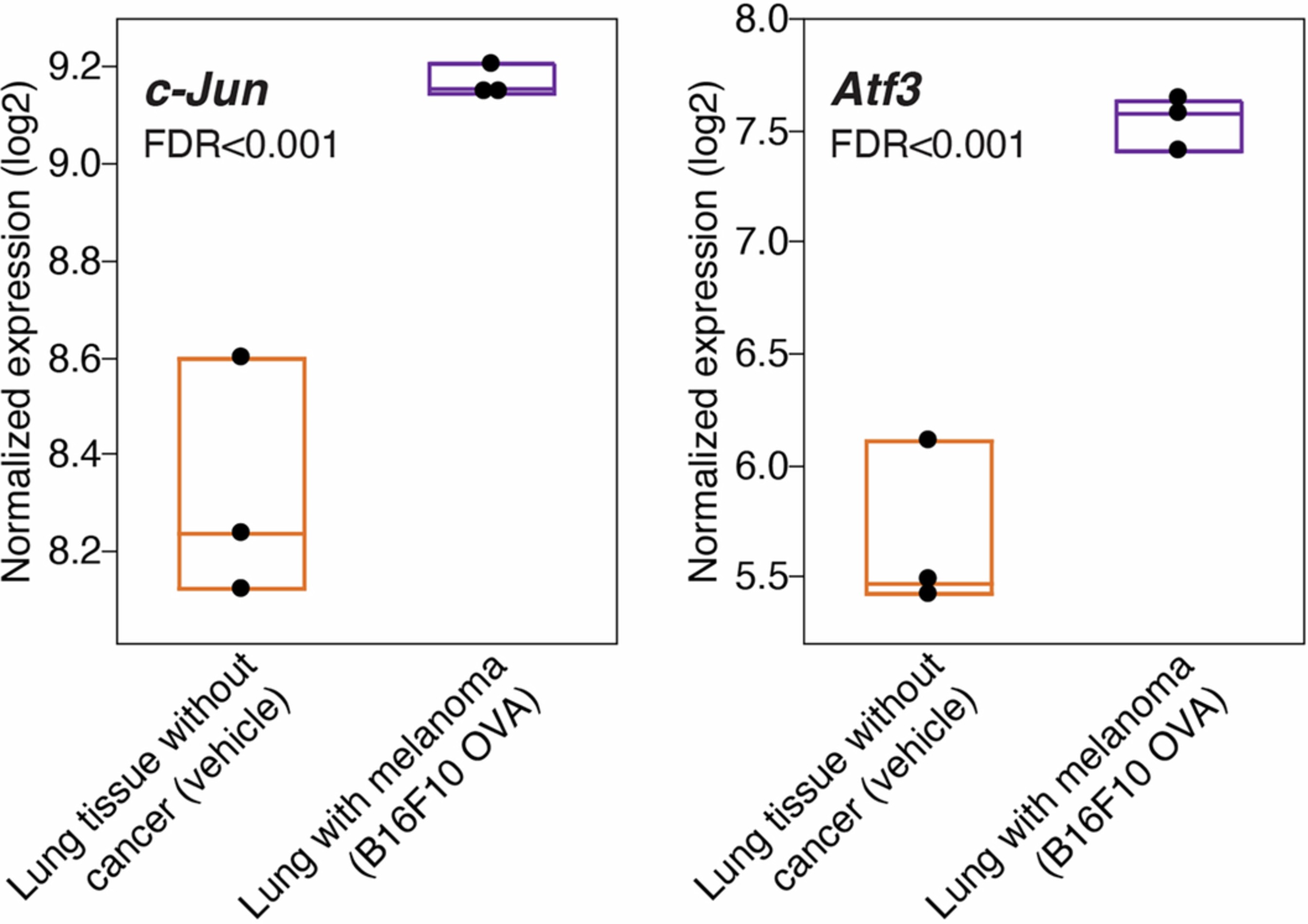 Extended Data Fig. 2: Cancer-induced nerve injury (CINI) in a metastatic disease model.
