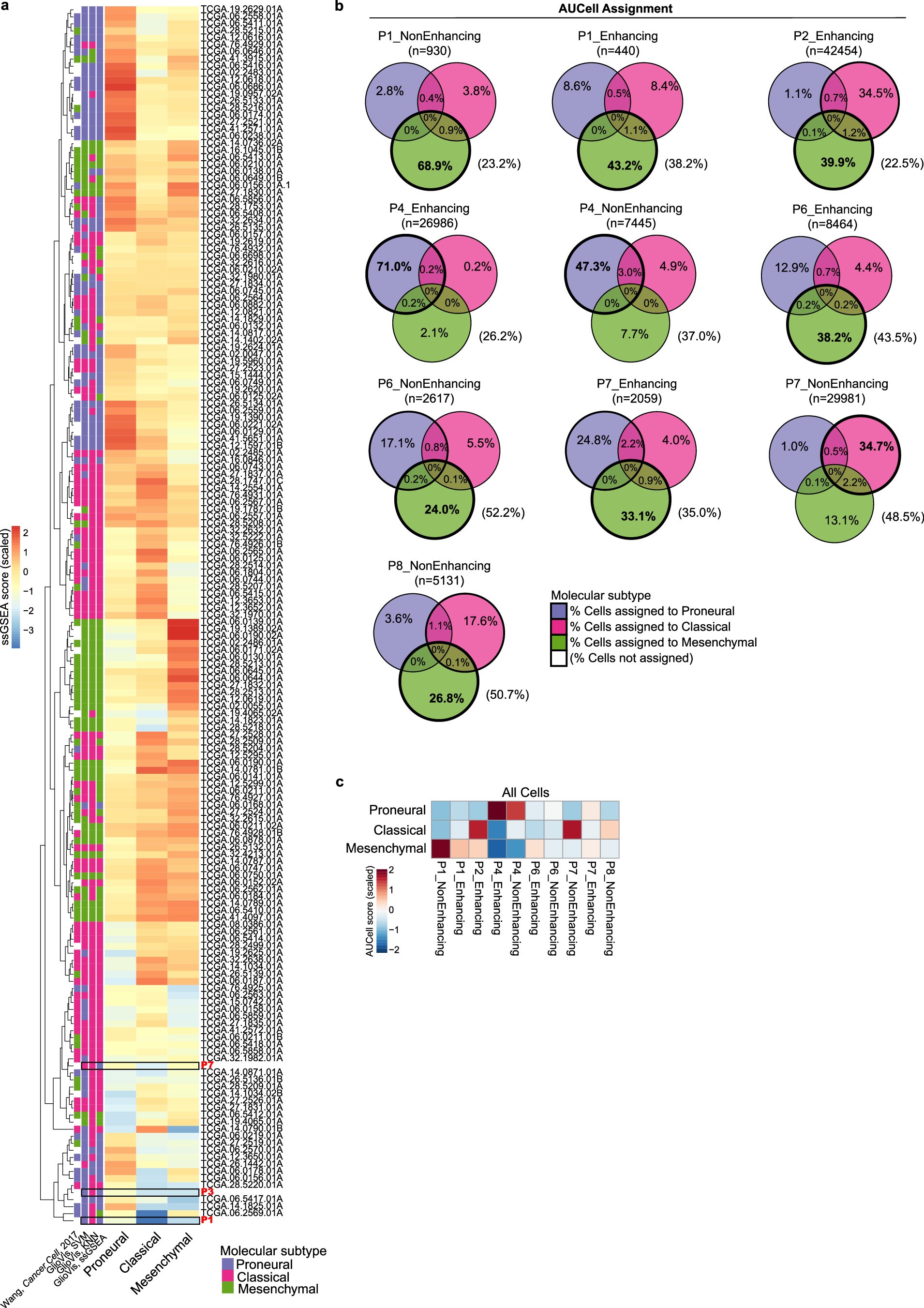 Extended Data Fig. 1: Transcriptional profiling of human brain tumours.