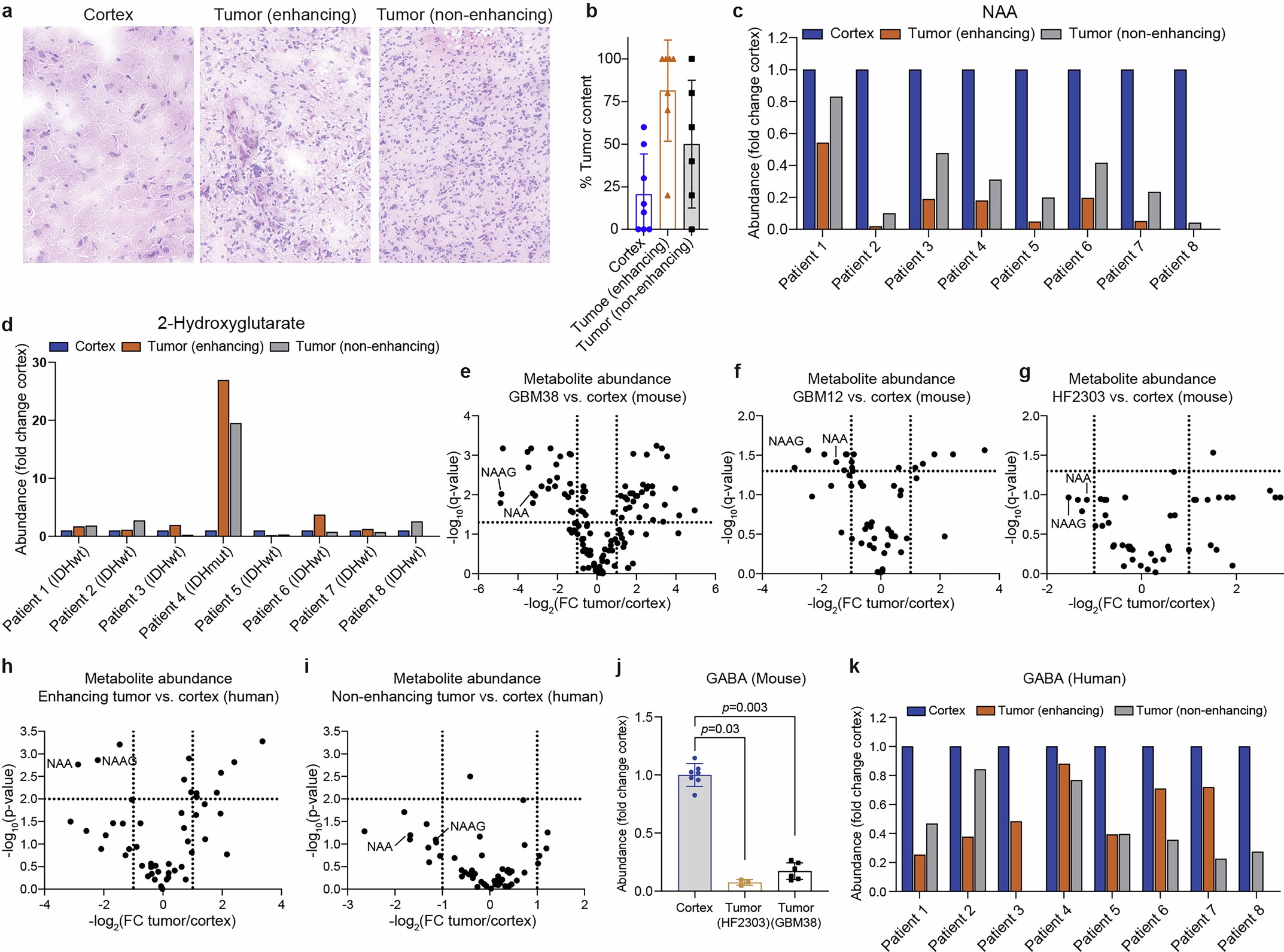 Extended Data Fig. 2: Histological and metabolic validation of tumour and cortex sample separation.