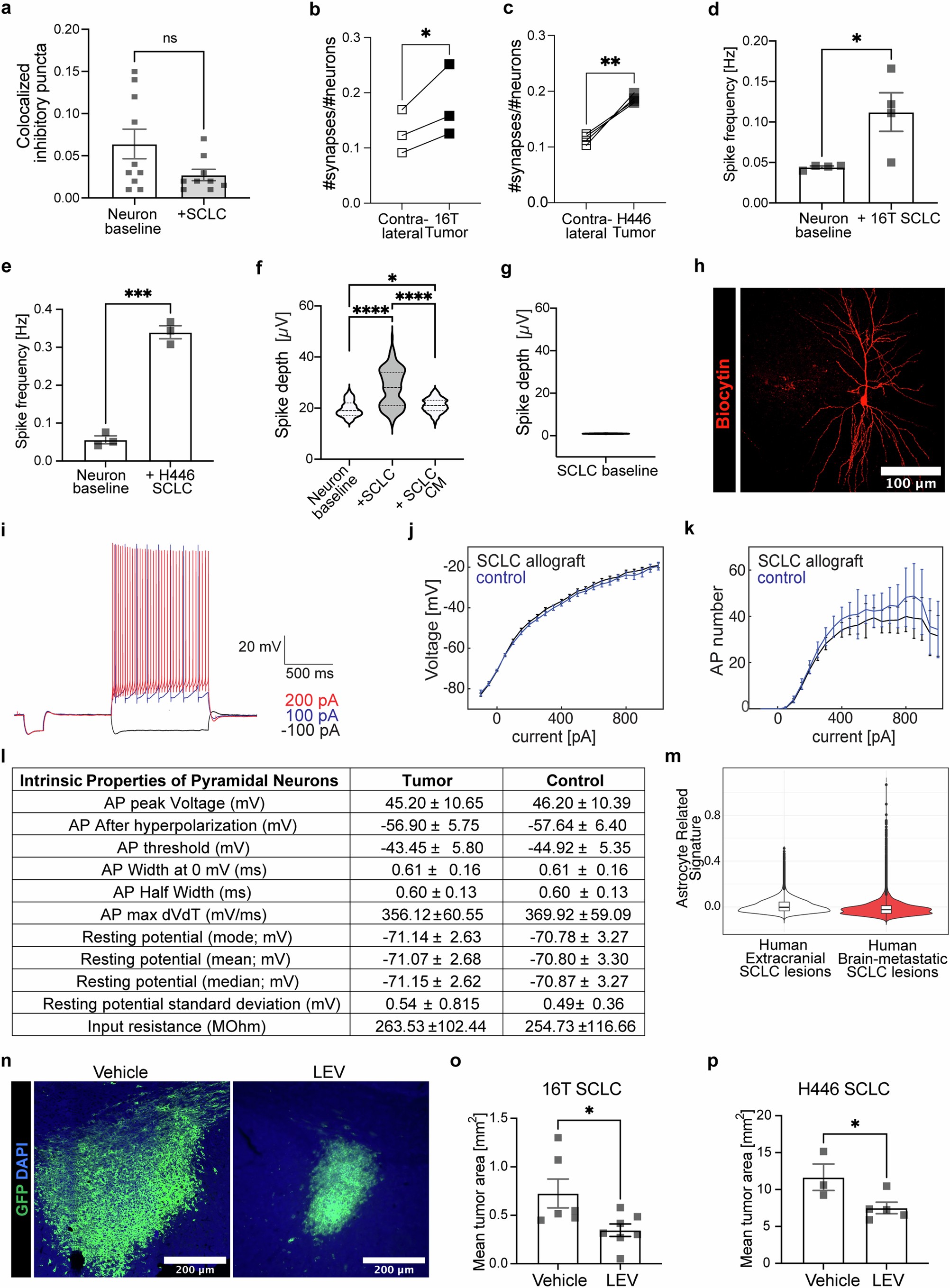 Extended Data Fig. 12: Bidirectional neuron-SCLC interactions drive peritumoral hyperexcitability.