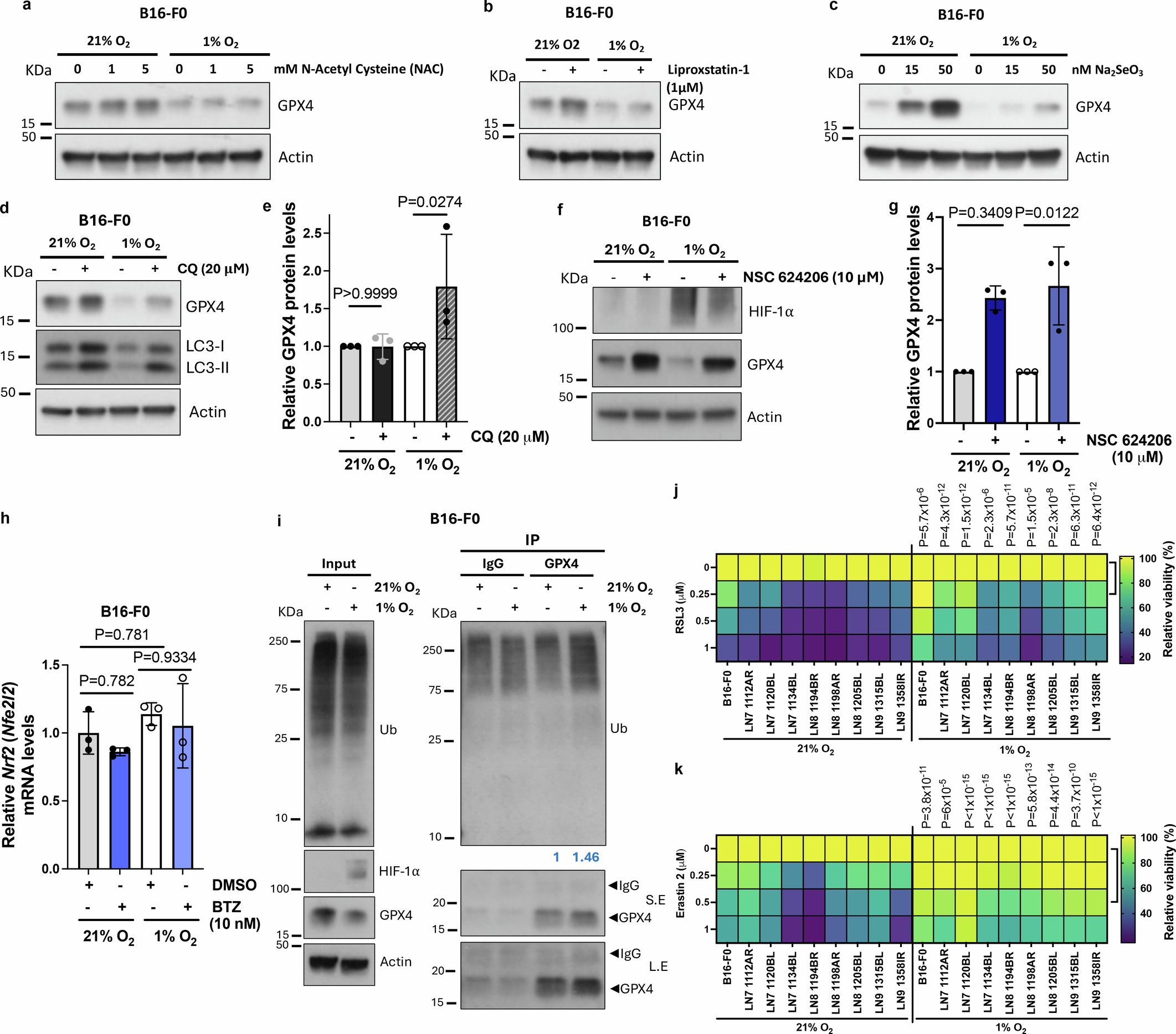 Extended Data Fig. 6: GPX4 is downregulated by UPS under low oxygen levels, independent of antioxidants, selenium, or autophagy.