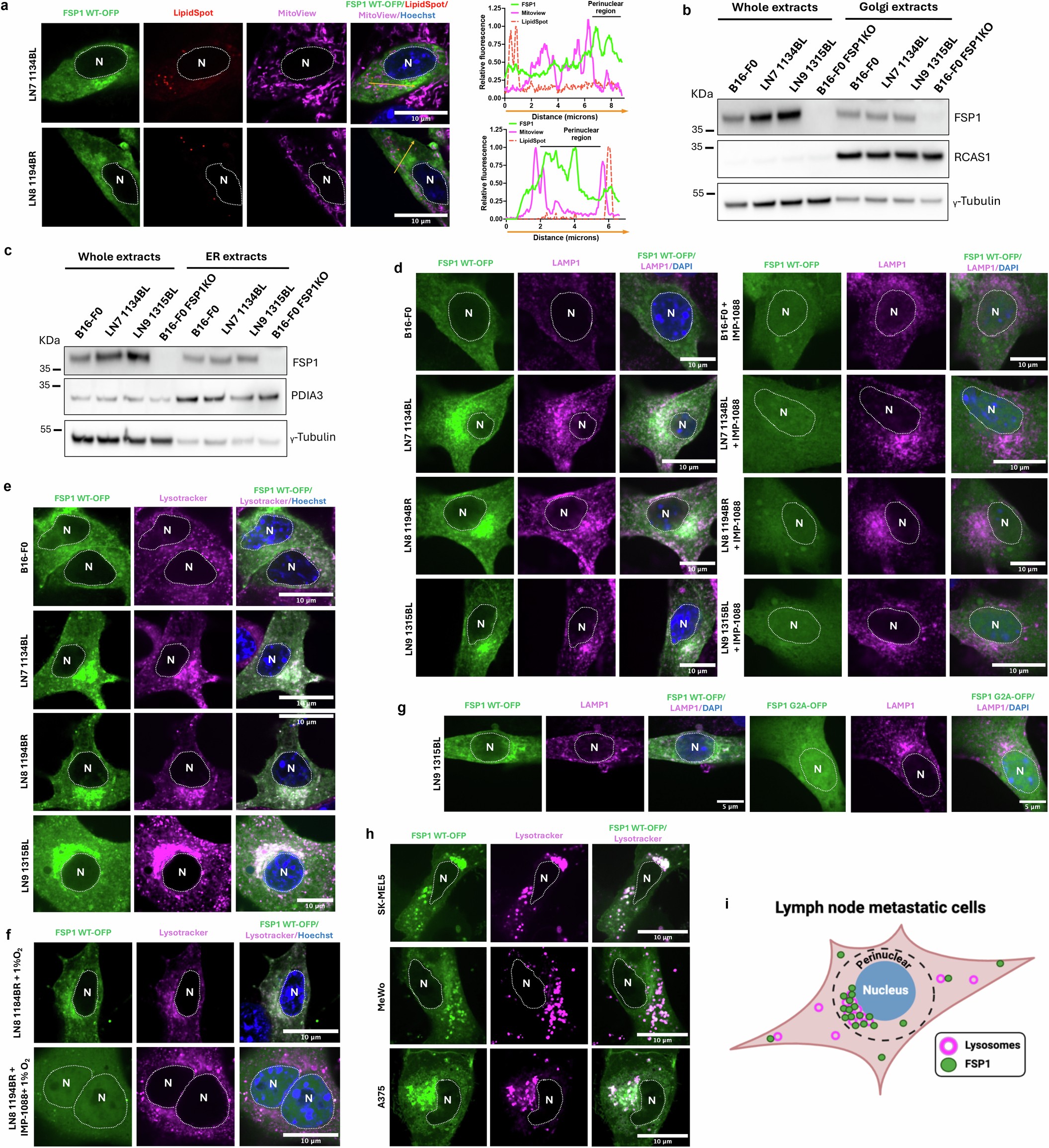 Extended Data Fig. 7: FSP1 preferentially localizes to perinuclear lysosomes in LN metastatic lines.