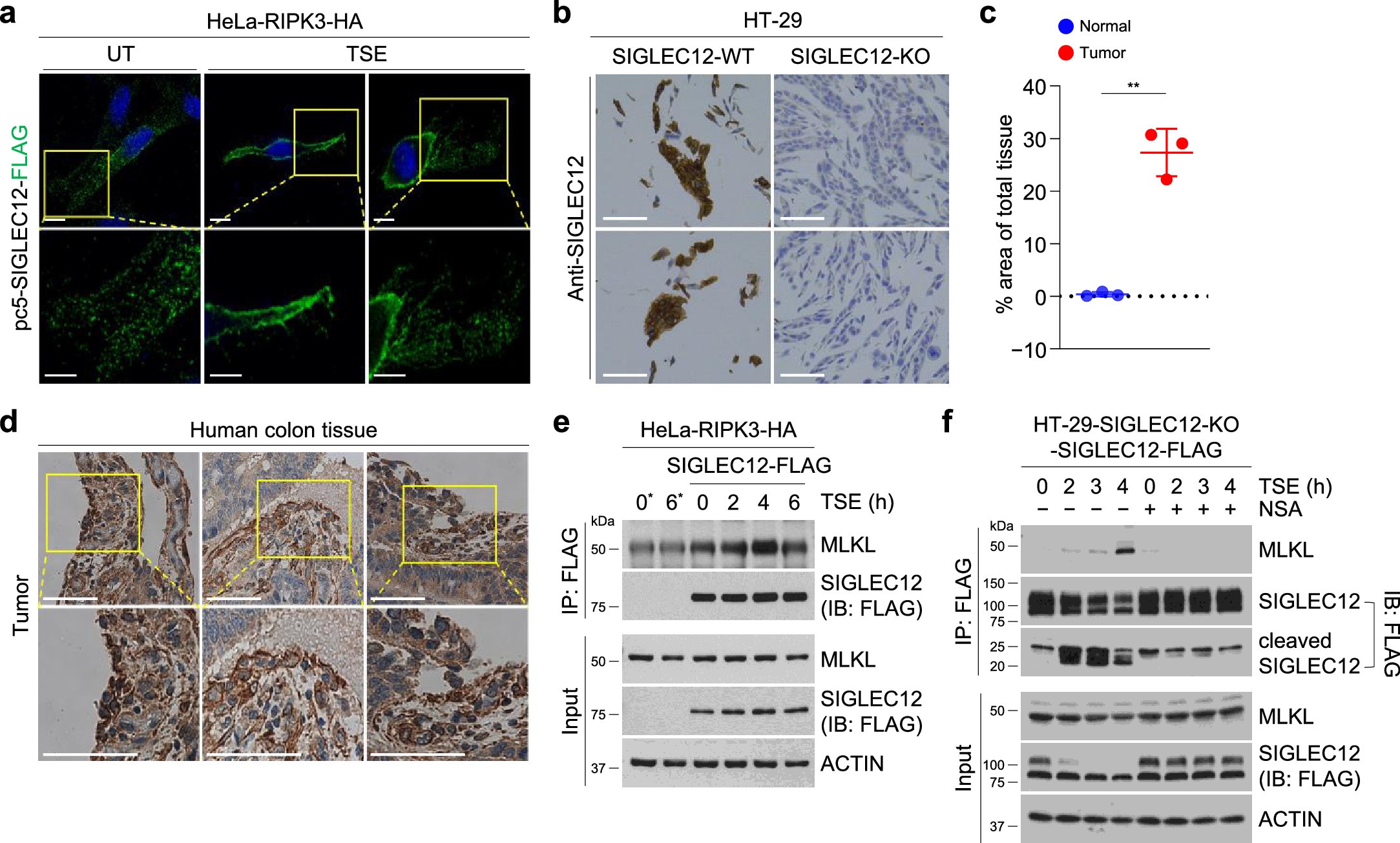Extended Data Fig. 6: Regulation of SIGLEC12 during necroptosis.