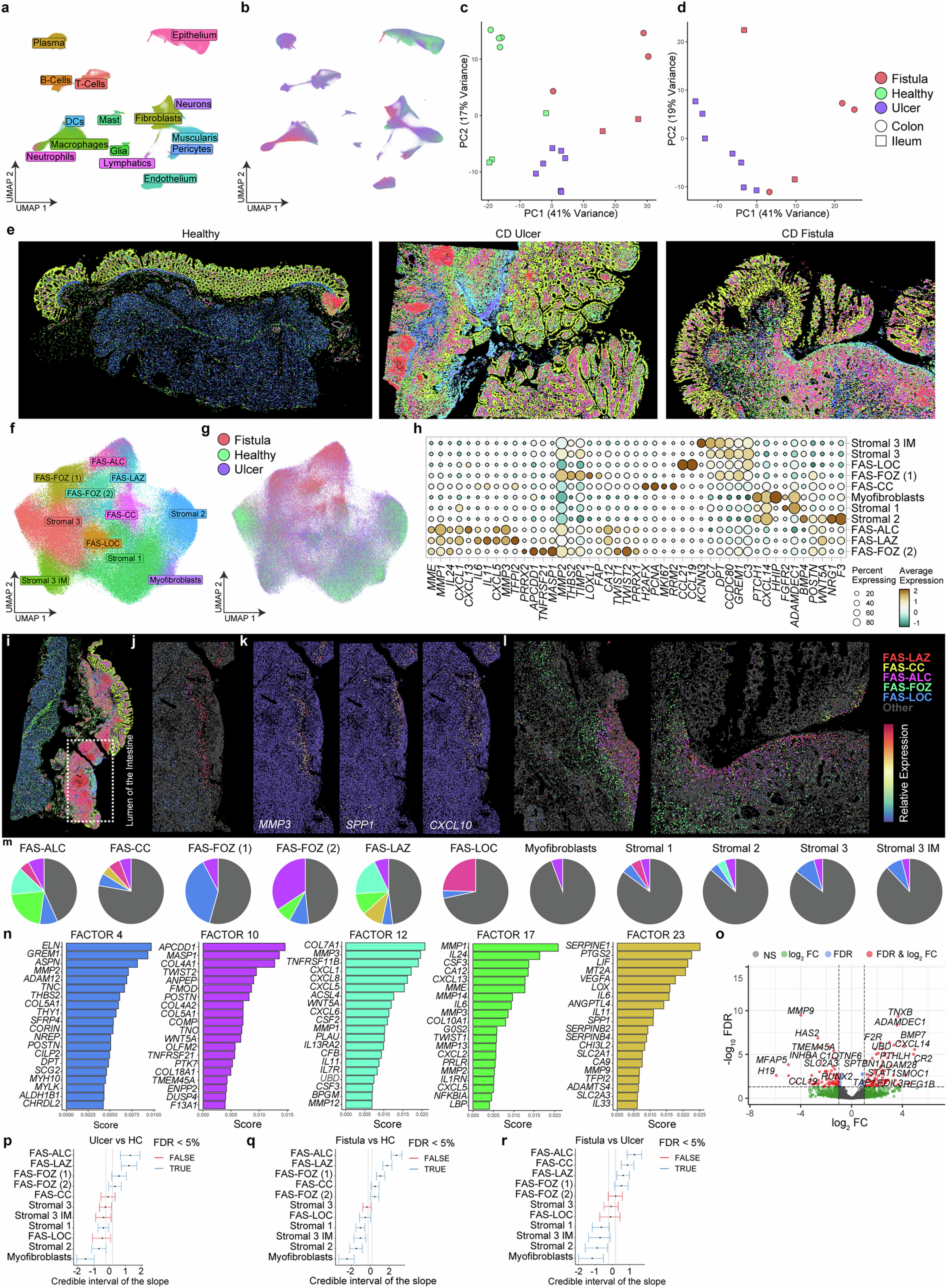 Extended Data Fig. 10: Spatial analysis of ulcer bases in Crohn’s disease.