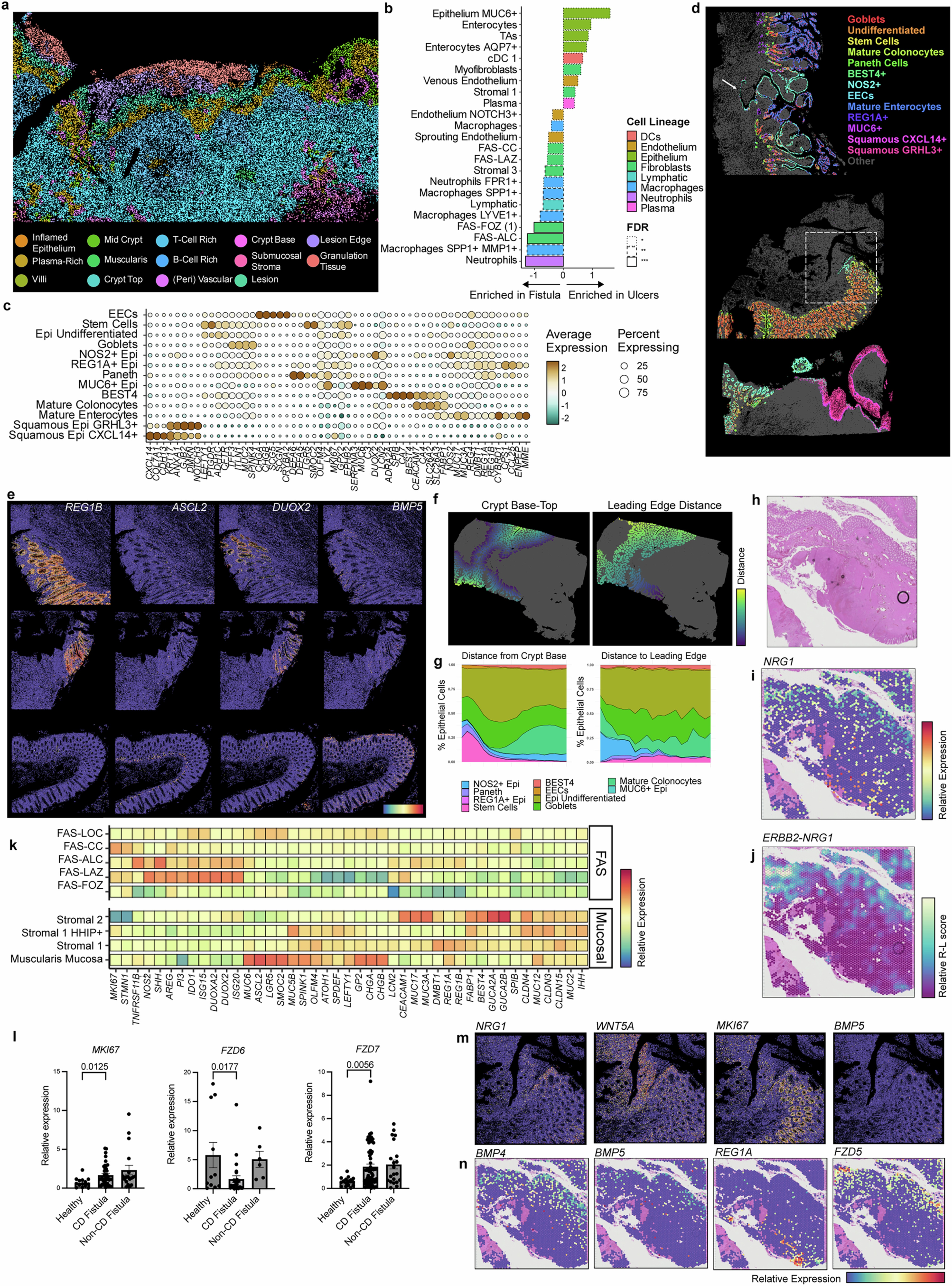 Extended Data Fig. 11: Leading edge of fistula tract epithelization.