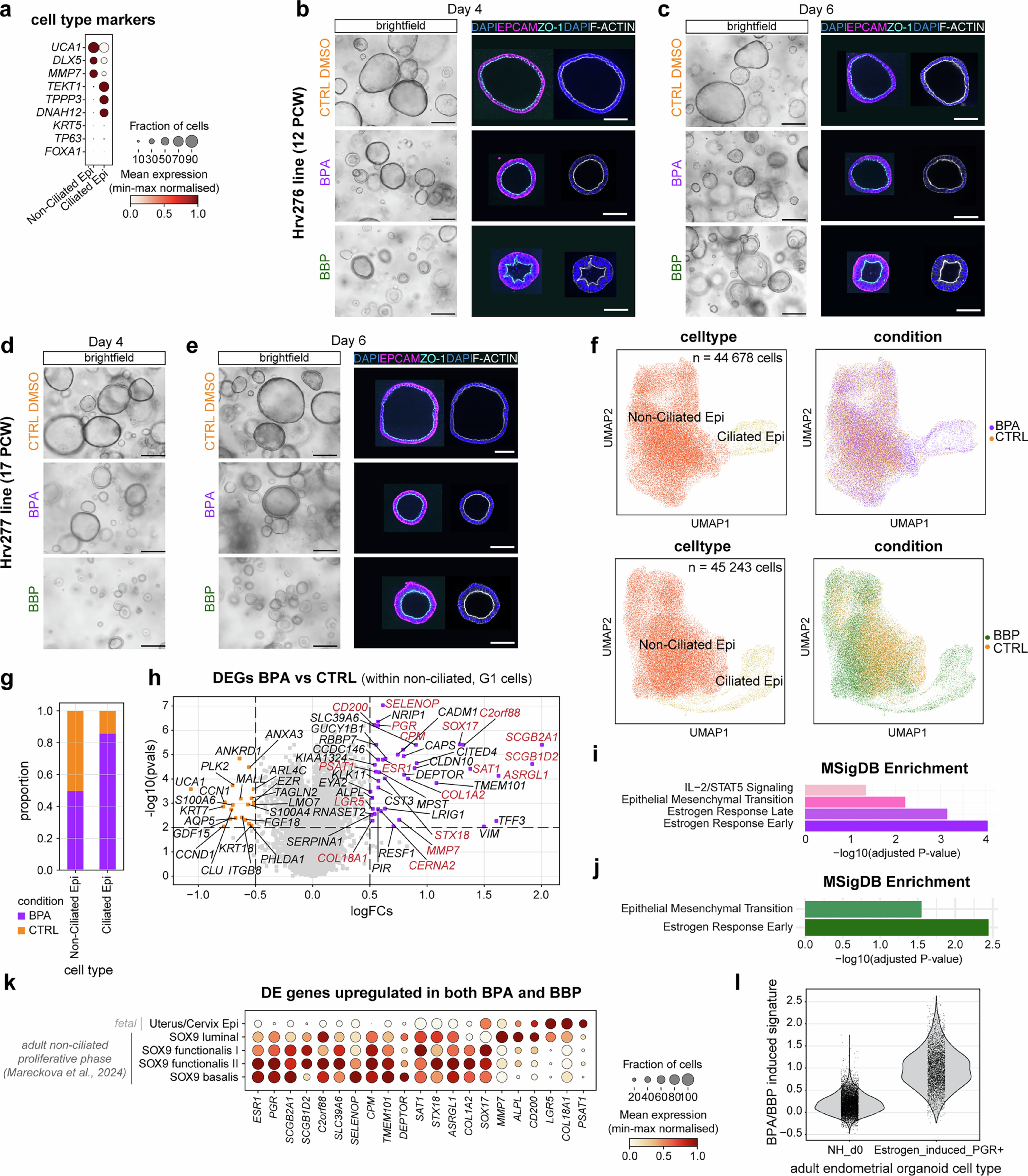 Extended Data Fig. 10: Exposure of fetal-derived uterine epithelial organoids to endocrine disrupting chemicals.