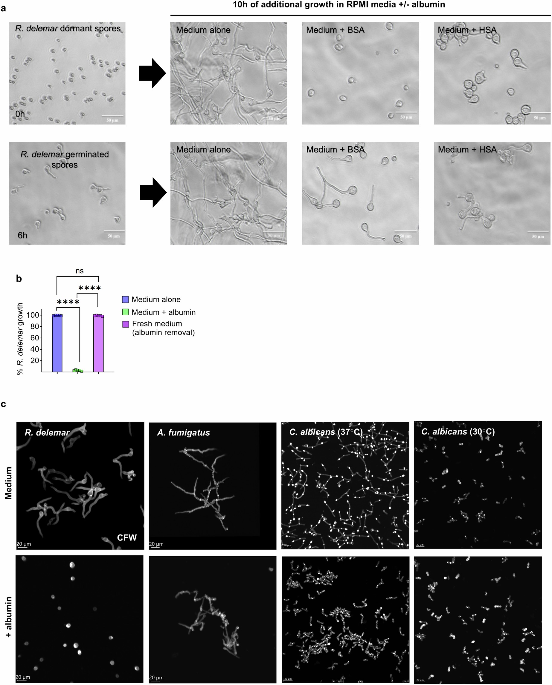 Extended Data Fig. 2: Selective fungistatic activity of albumin against Mucorales.