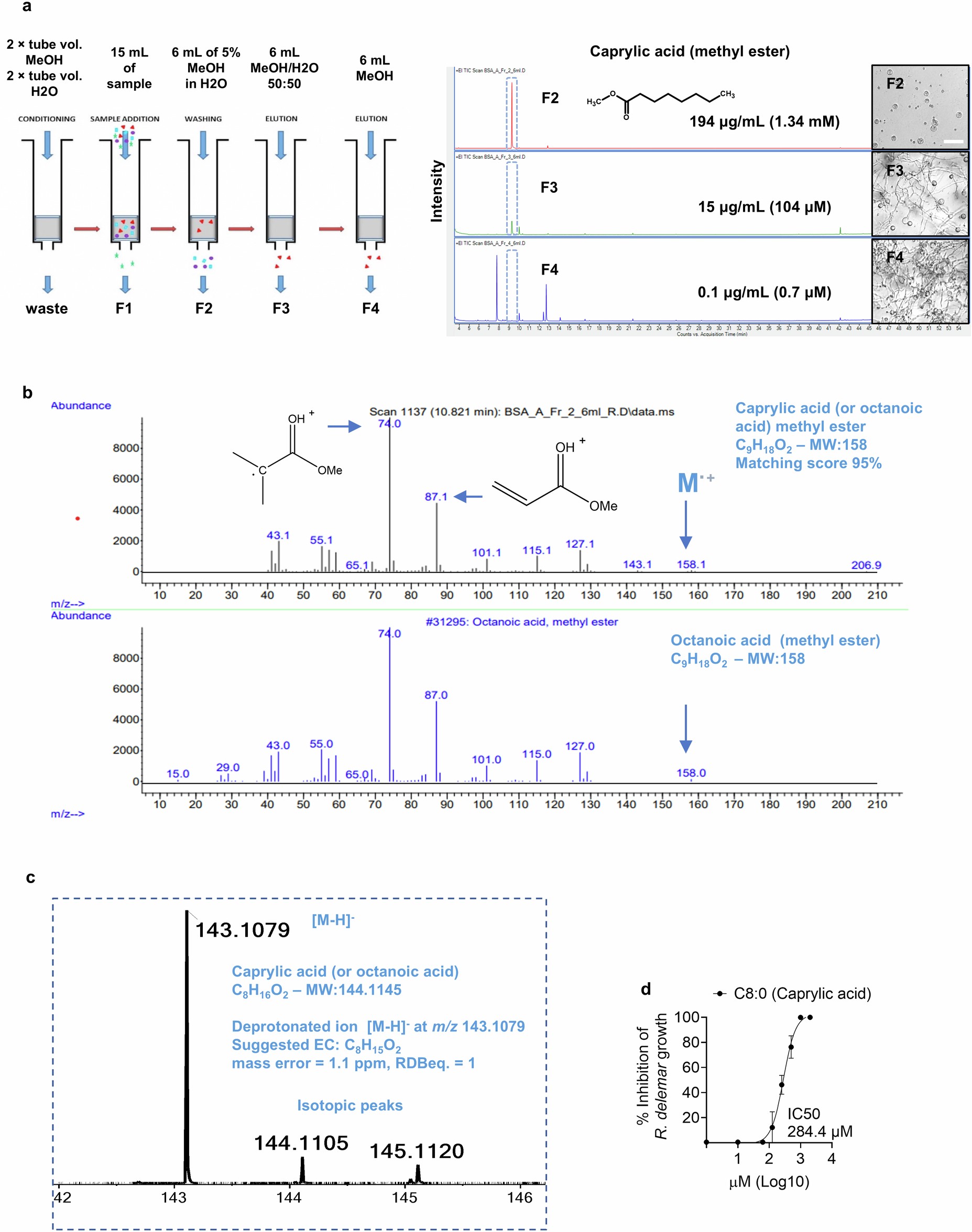 Extended Data Fig. 4: Analysis of activity and FFA composition in albumin filtrate.