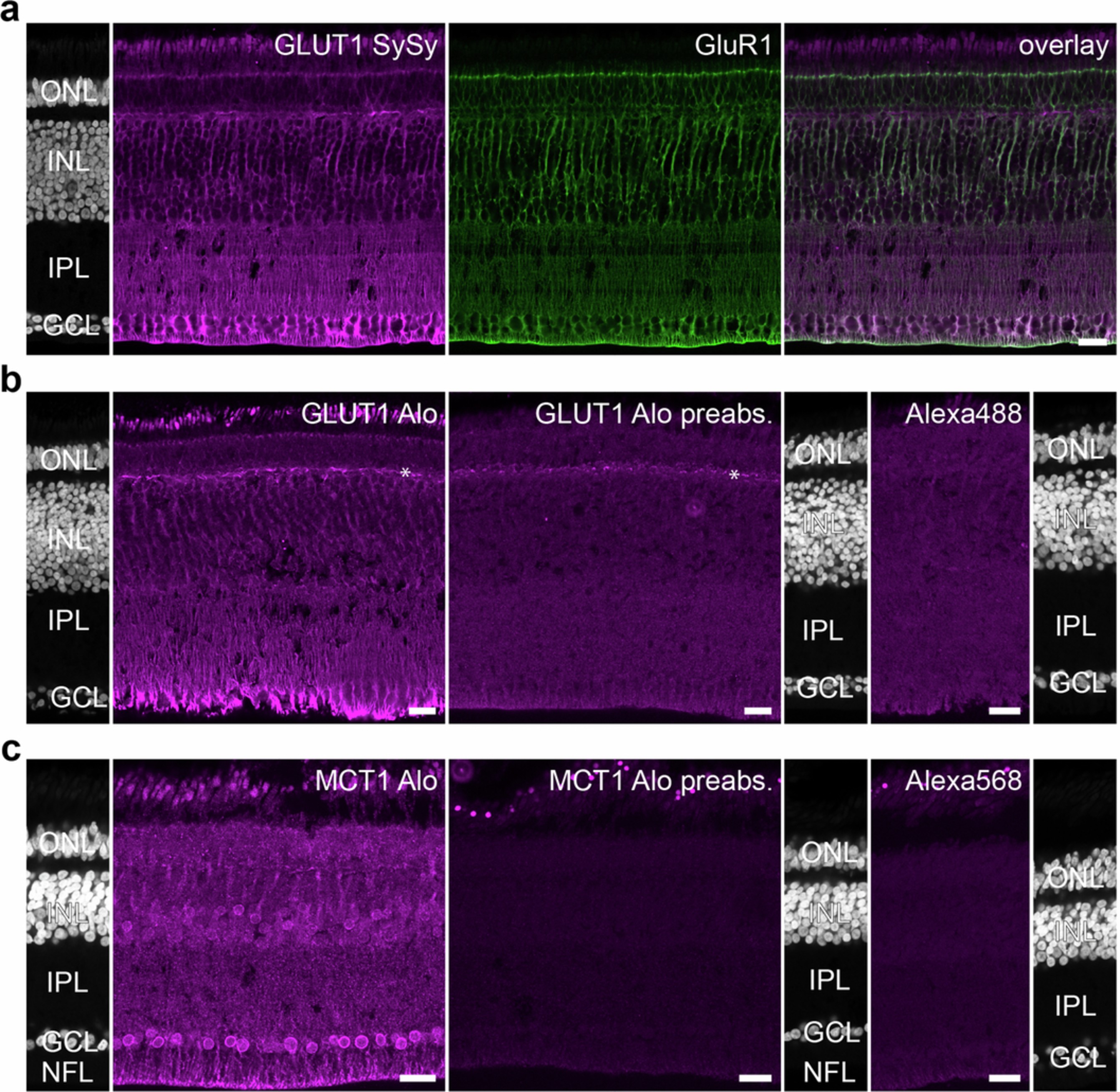 Extended Data Fig. 6: Specificity of GLUT1 and MCT1 antibodies.