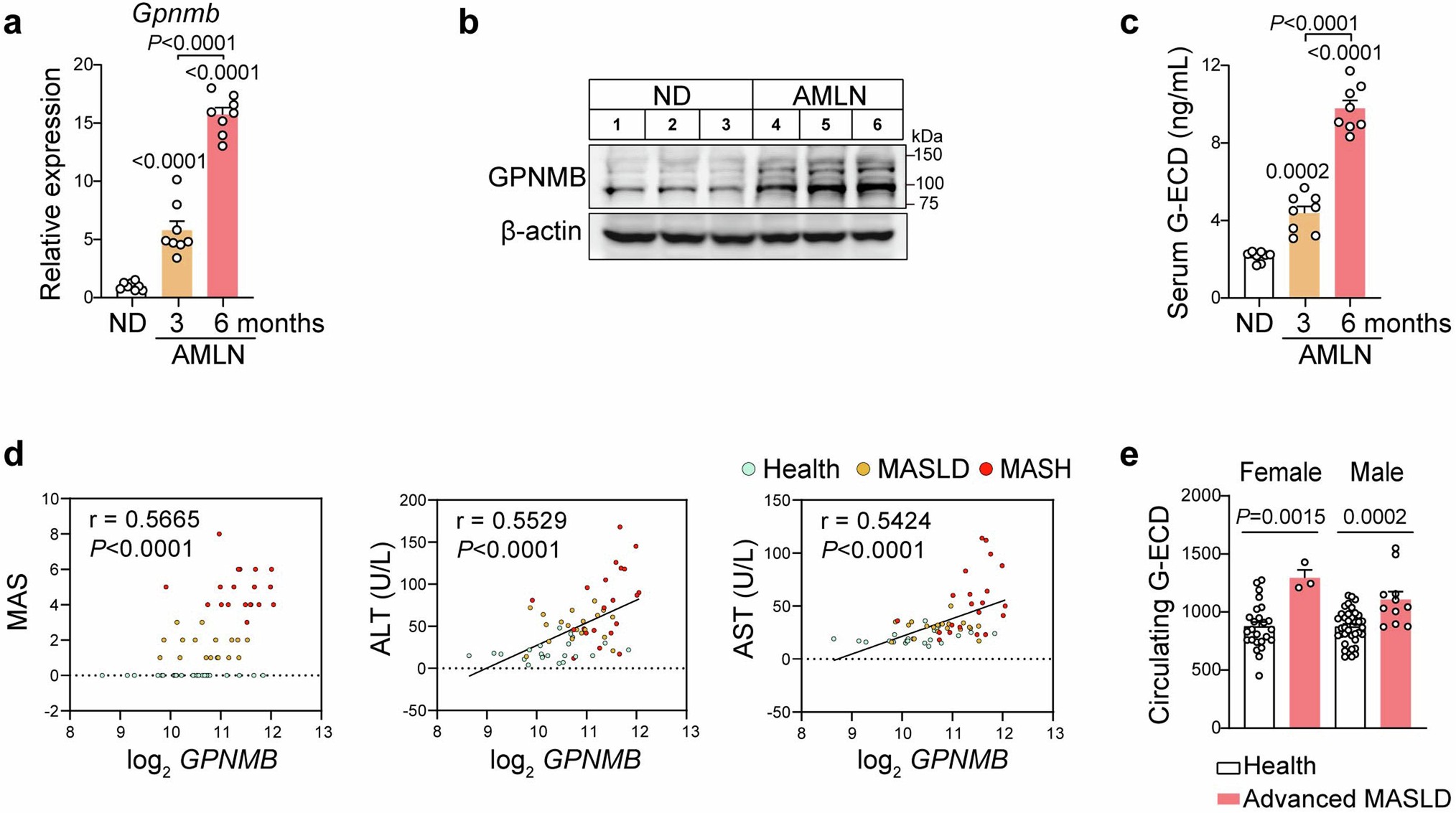 Extended Data Fig. 5: Hepatic GPNMB and circulating G-ECD are positively associated with MASH severity.