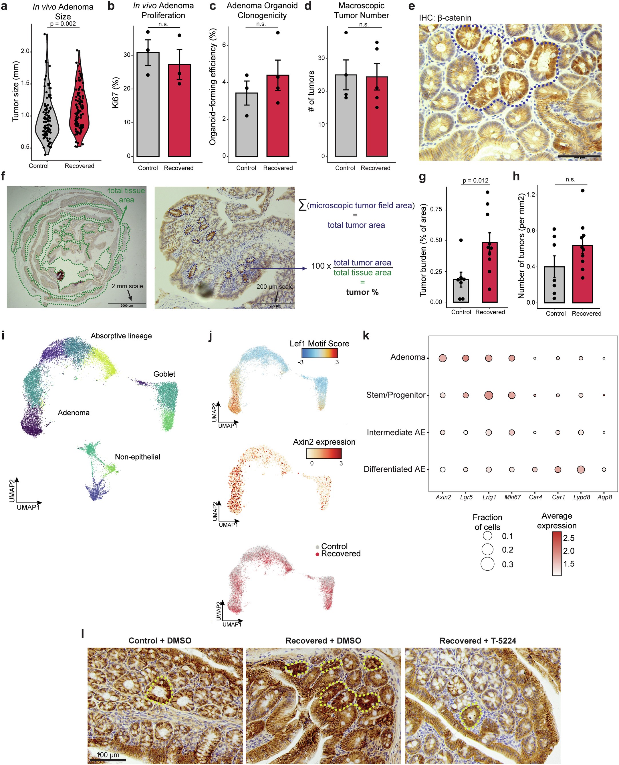 Extended Data Fig. 9: Features of adenomas following colitis.