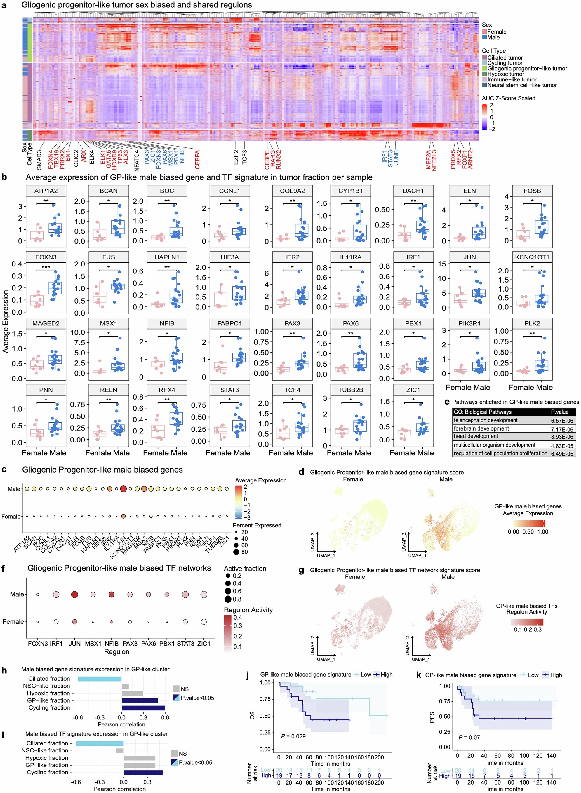 Extended Data Fig. 3: Progenitor-like tumour cells in male PFA-EPNs upregulate transcriptional regulatory networks retained from early embryonic development and are associated with worse survival outcomes.