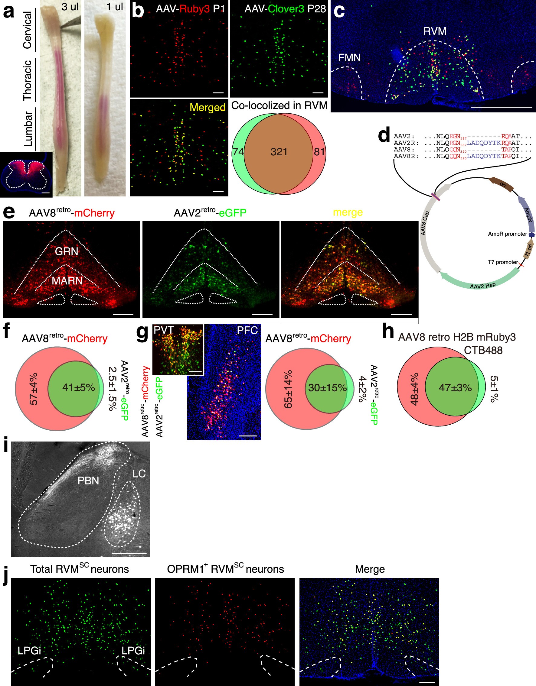 Extended Data Fig. 2: Developing and characterization of the neonatal intraspinal injection strategy and AAV8retro.