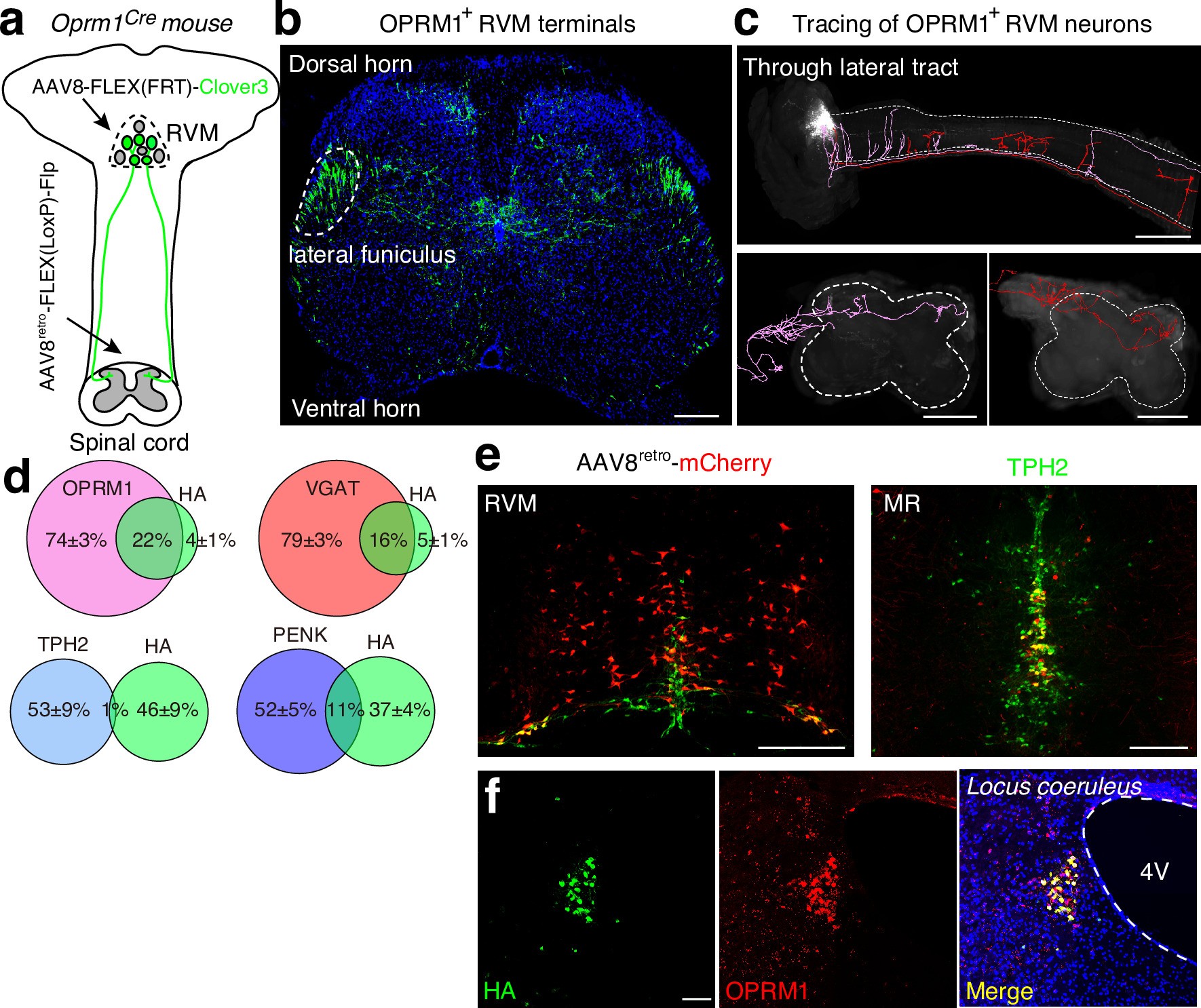 Extended Data Fig. 3: Characterization of OPRM1+ RVMSC neurons.