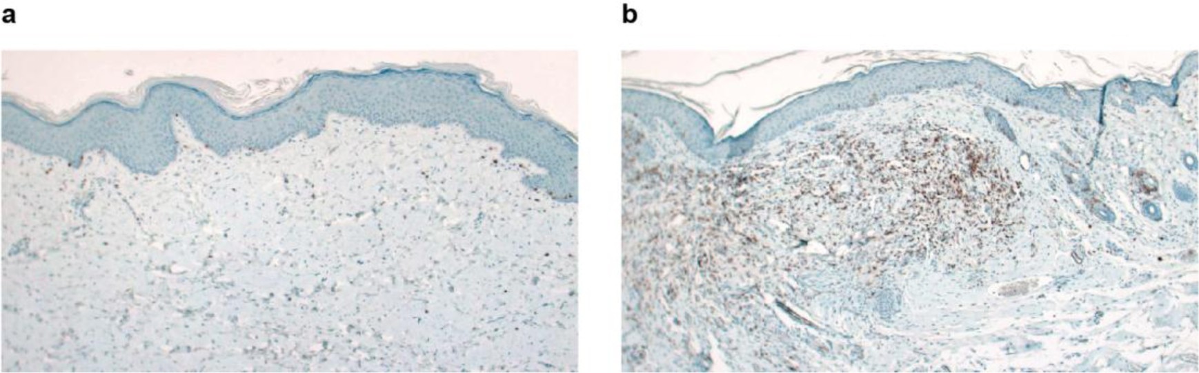 Supplementary Figure 7: Skin grafts from mice treated with CART.BiTE cells.