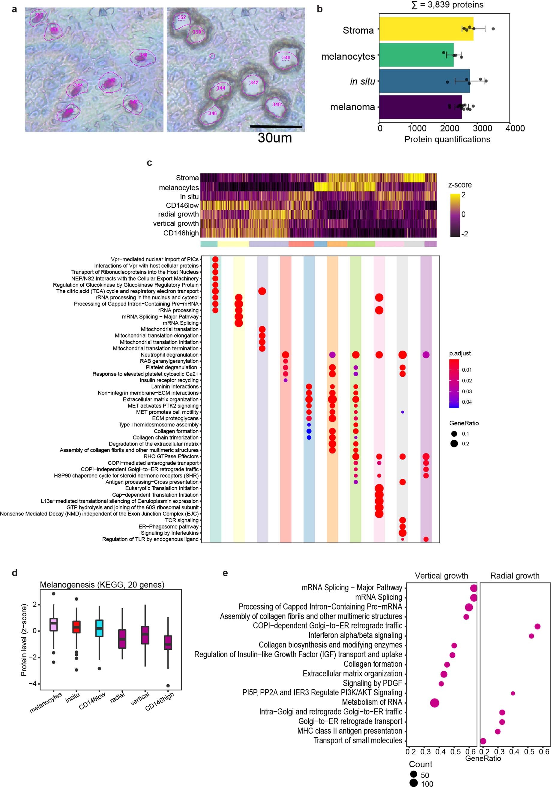Extended Data Fig. 5: DVP applied to archival tissue of primary melanoma.