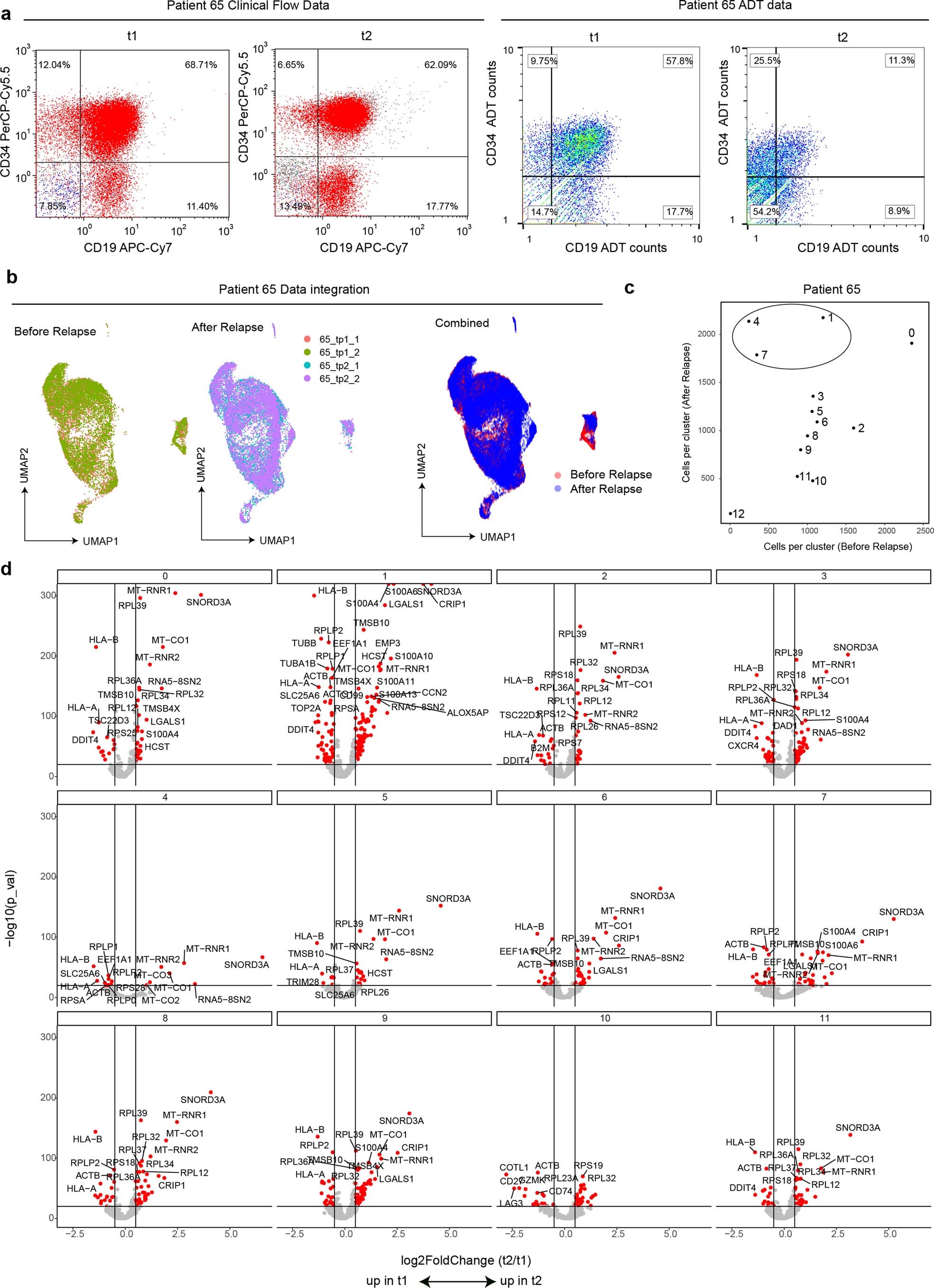 Extended Data Fig. 9: Analysis of PIP-seq data from MPAL Patient 65.