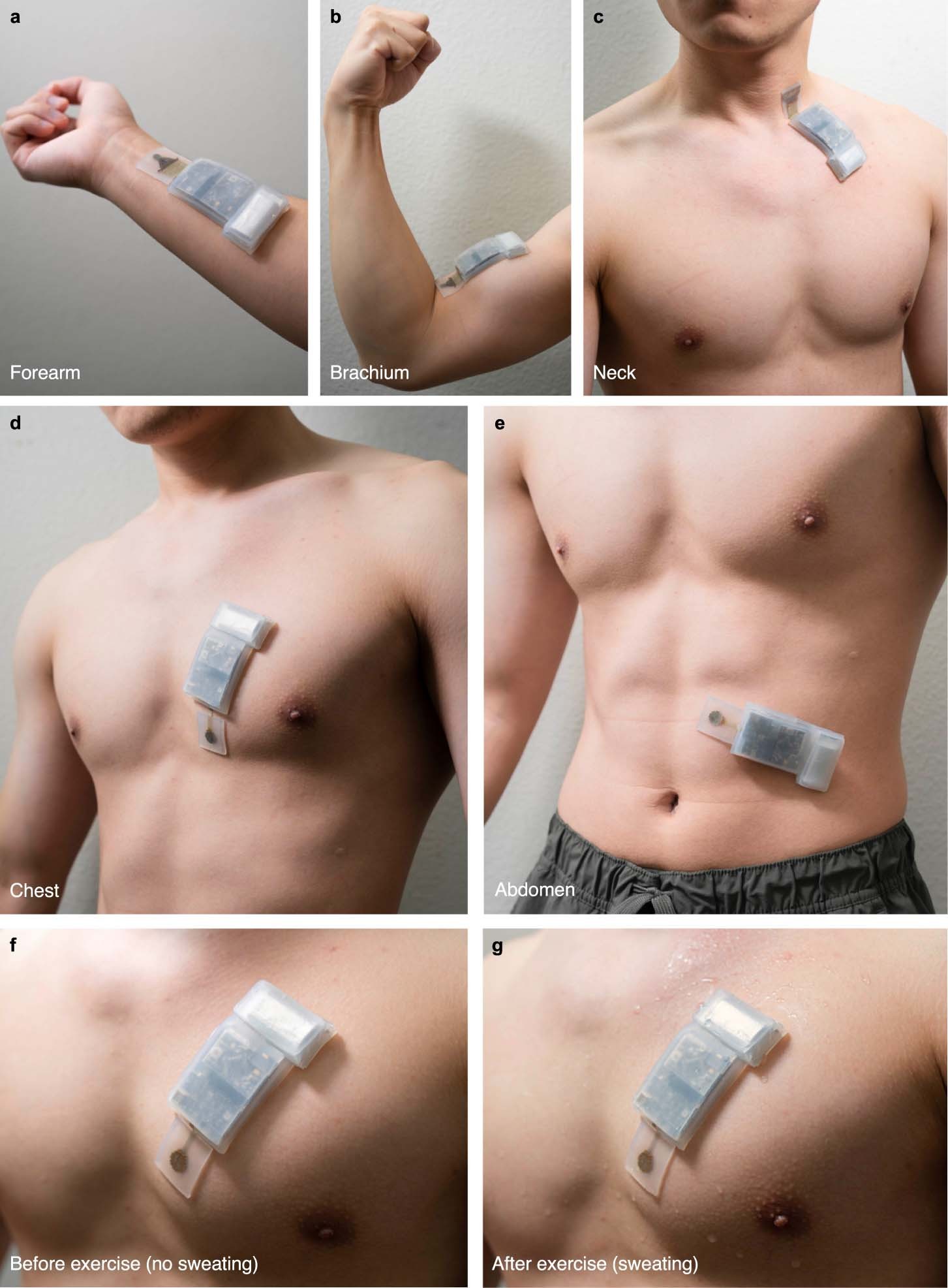 Extended Data Fig. 4: Skin integration of the conformal USoP device.