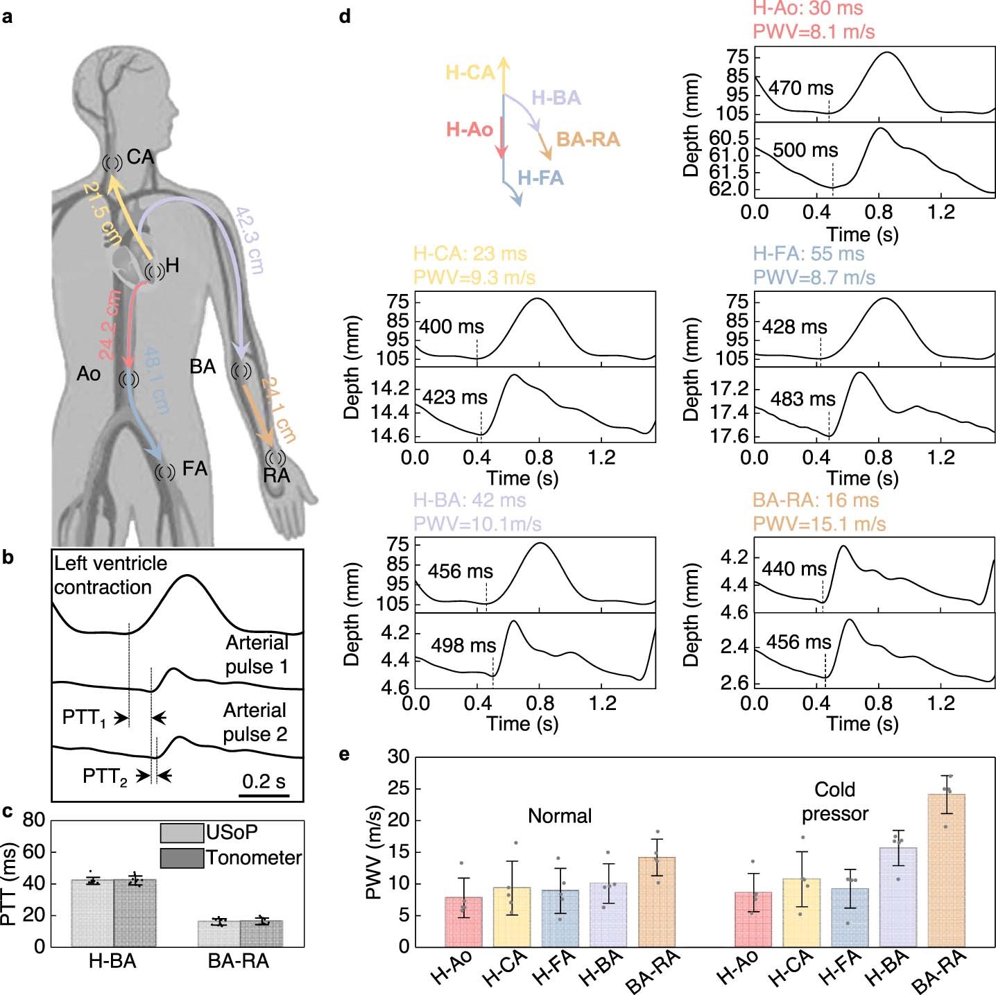 Extended Data Fig. 5: Pulse wave velocity (PWV) measurements.