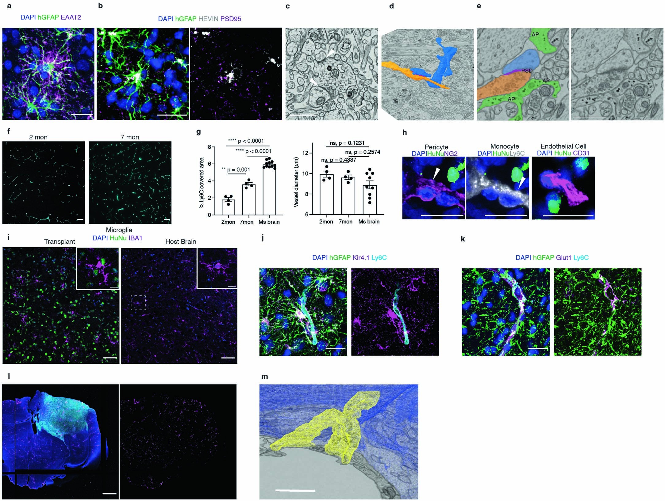 Extended Data Fig. 6: Close association of human protoplasmic astrocytes with synapses and host vasculature in engrafted glia-enriched cortical organoids.
