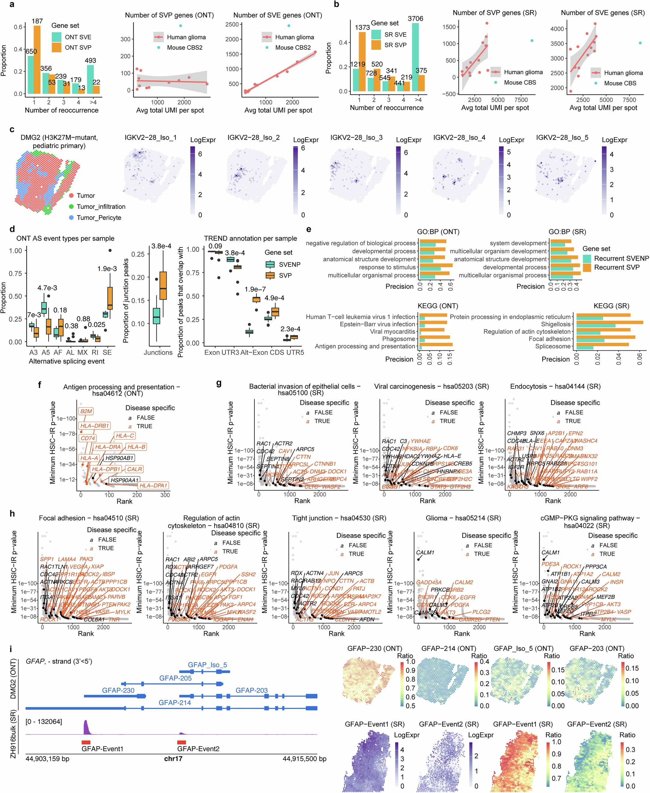 Extended Data Fig. 7: Additional examples of transcript diversity in human glioma, related to Fig. 6.