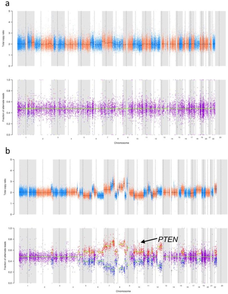 Supplementary Figure 12: Putative biallelic PTEN loss in progressing lesions from two patients with CB to anti-CTLA-4 therapy.
