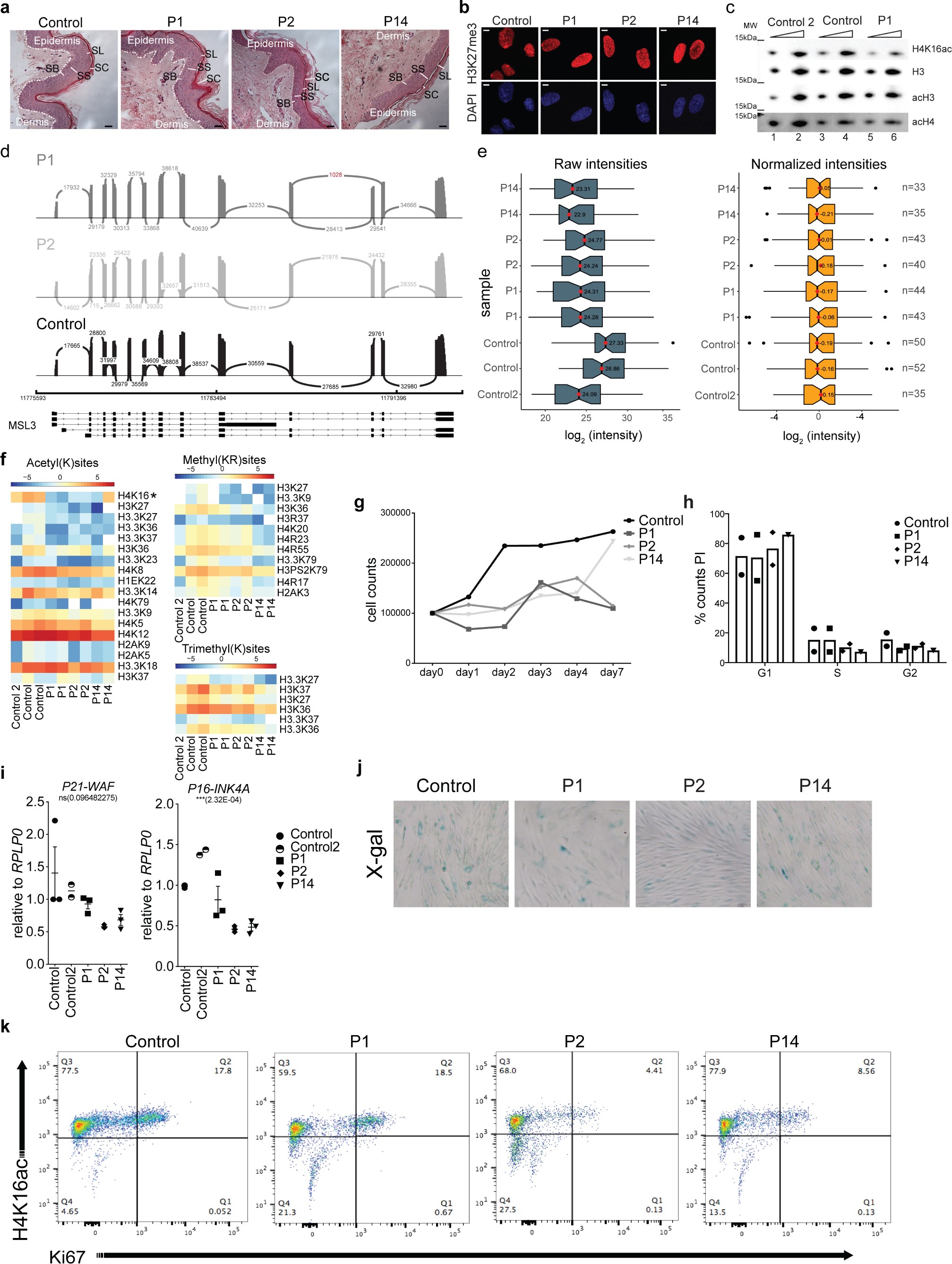Supplementary Figure 2: Characterization of MSL3 patient-derived fibroblasts.
