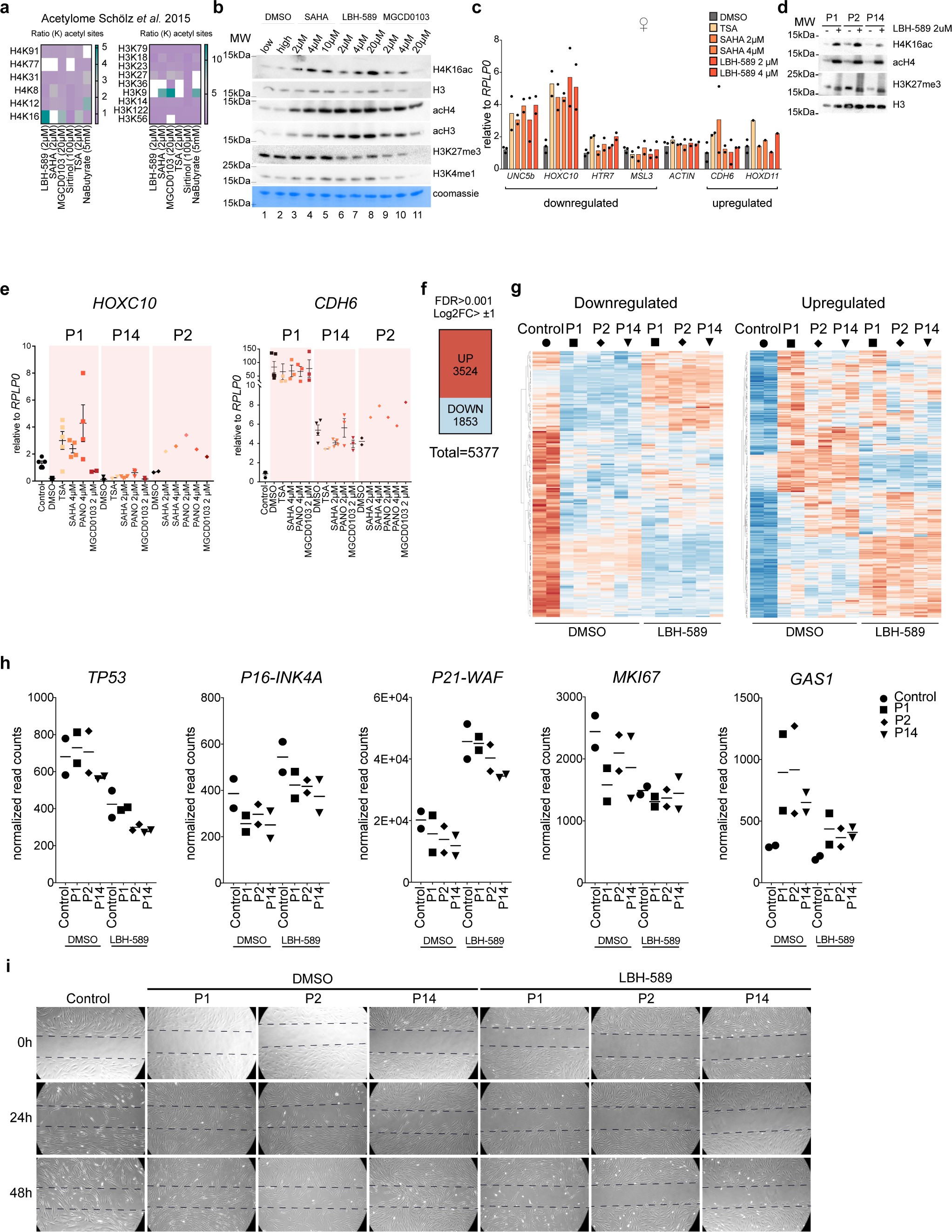 Supplementary Figure 4: Response to HDACi in MSL3 patient cells.