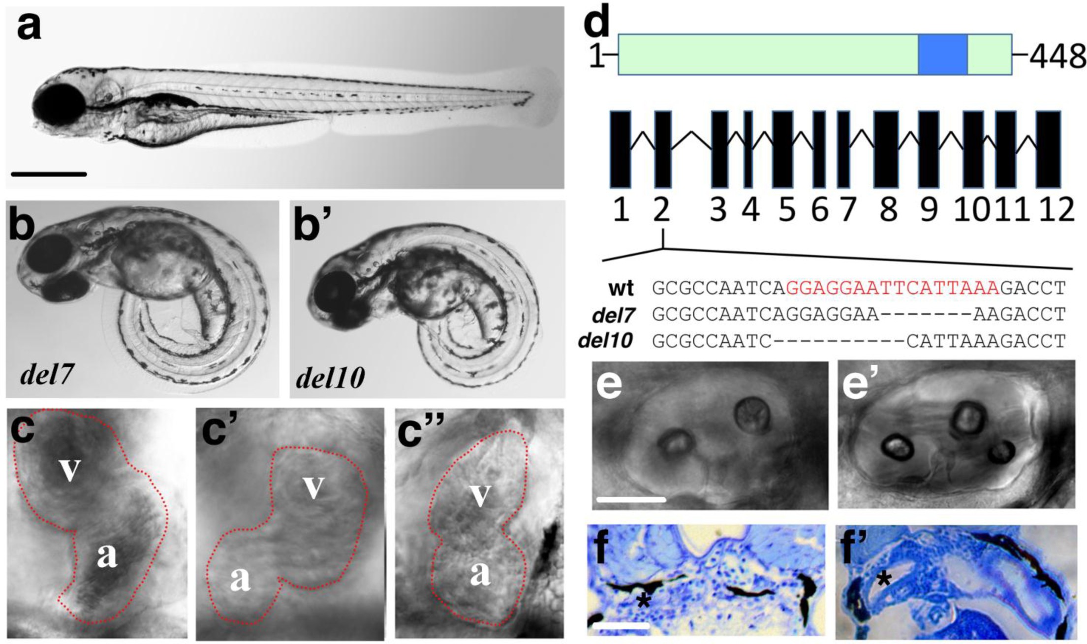 Supplementary Fig. 1: Phenotypes of zmynd10 mutants.