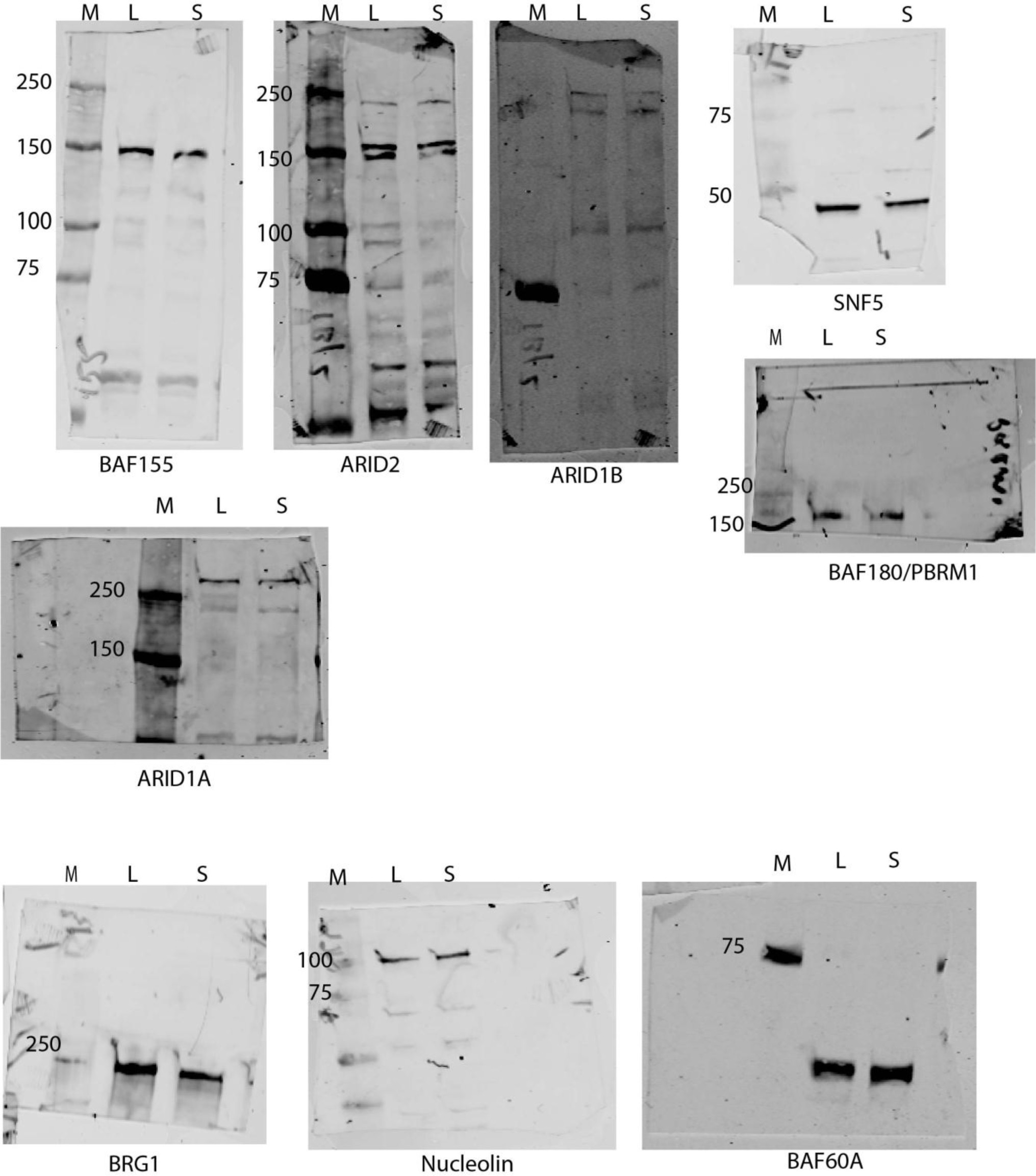 Supplementary Figure 2: Expression of SWI/SNF subunits in cell lines expressing SCHLAP1.