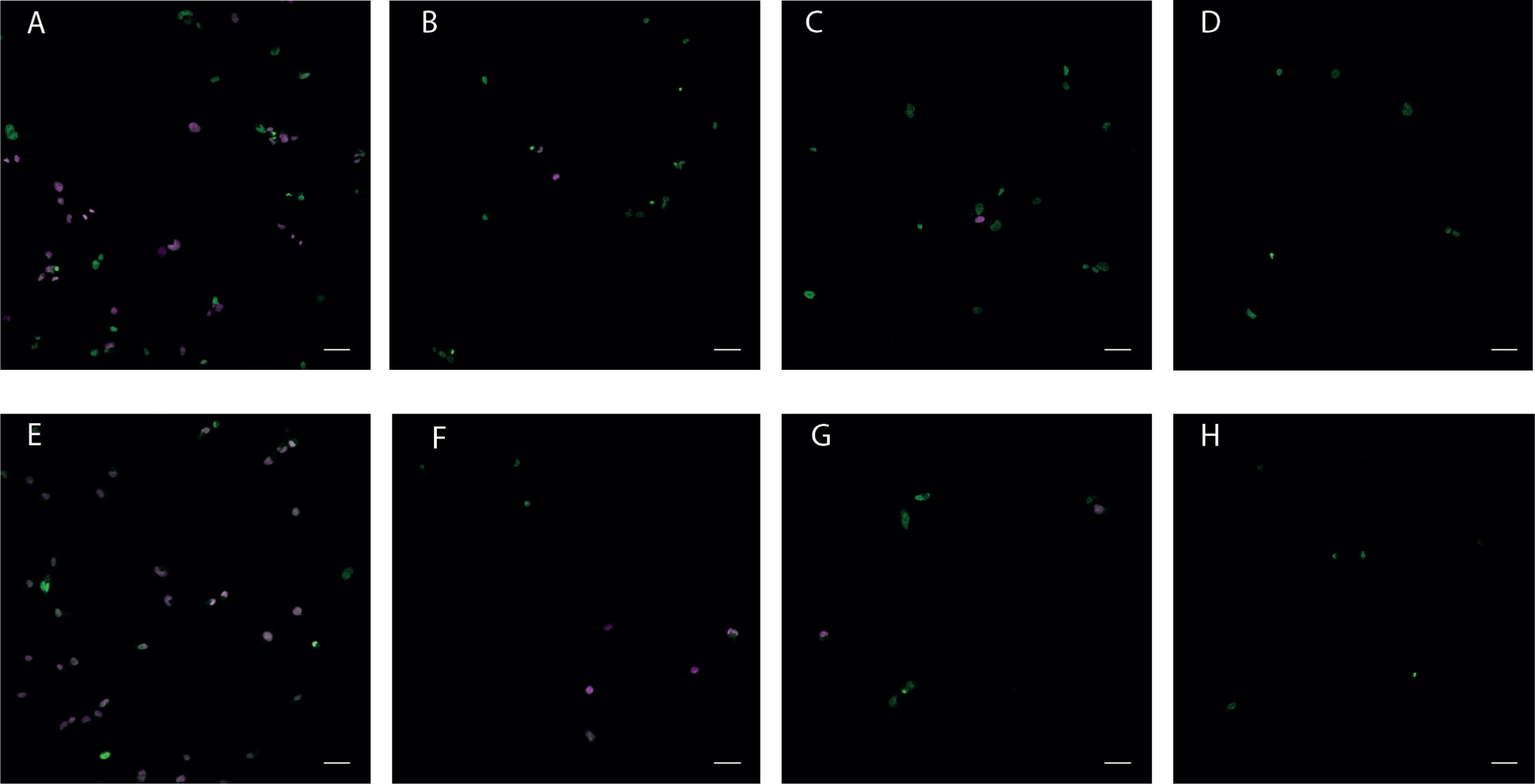 Supplementary Figure 11