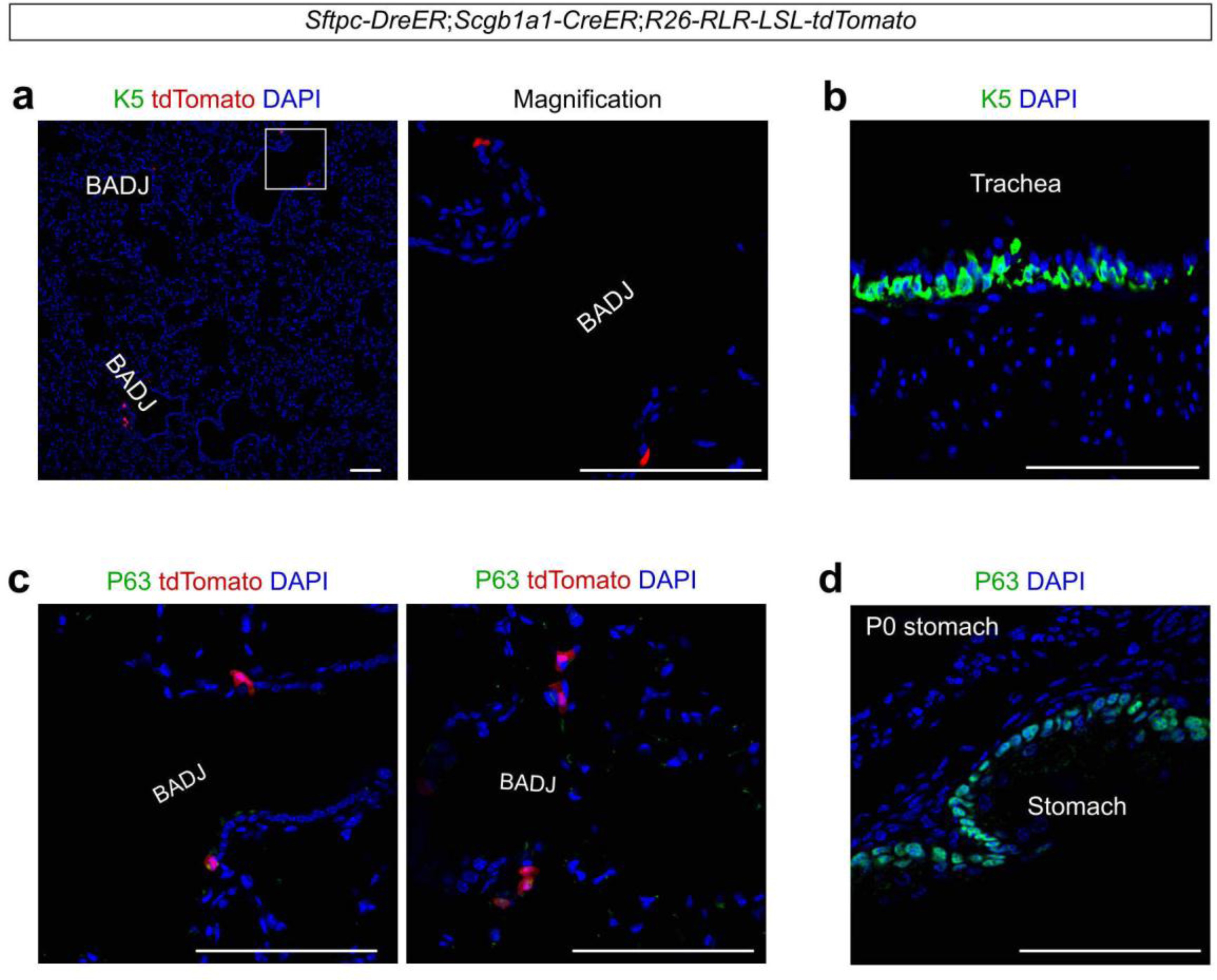 Supplementary Figure 6: BASCs-Tracer does not label K5+ or P63+ cells.
