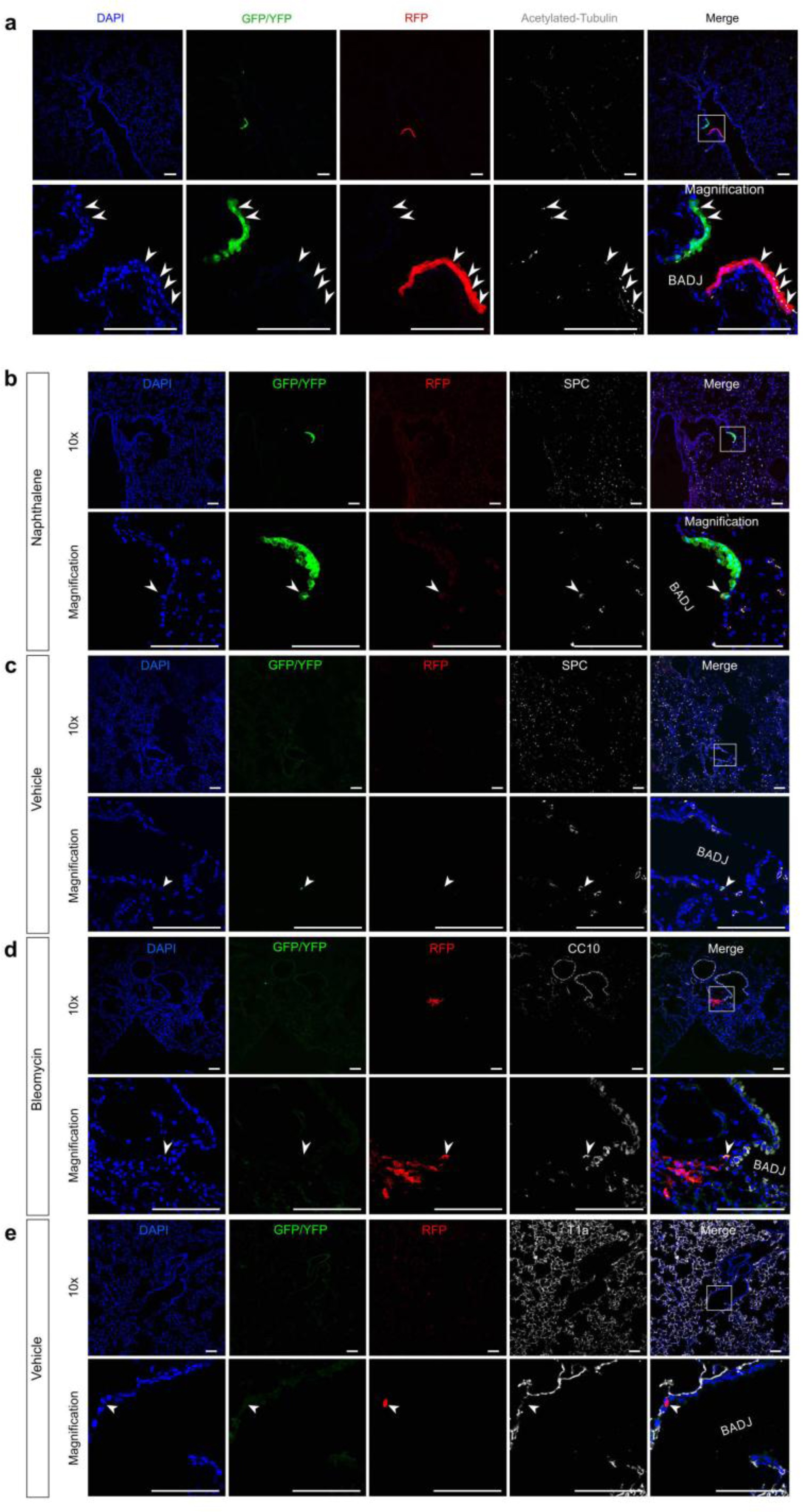 Supplementary Figure 14: Clonal analysis of BASCs after lung injuries.
