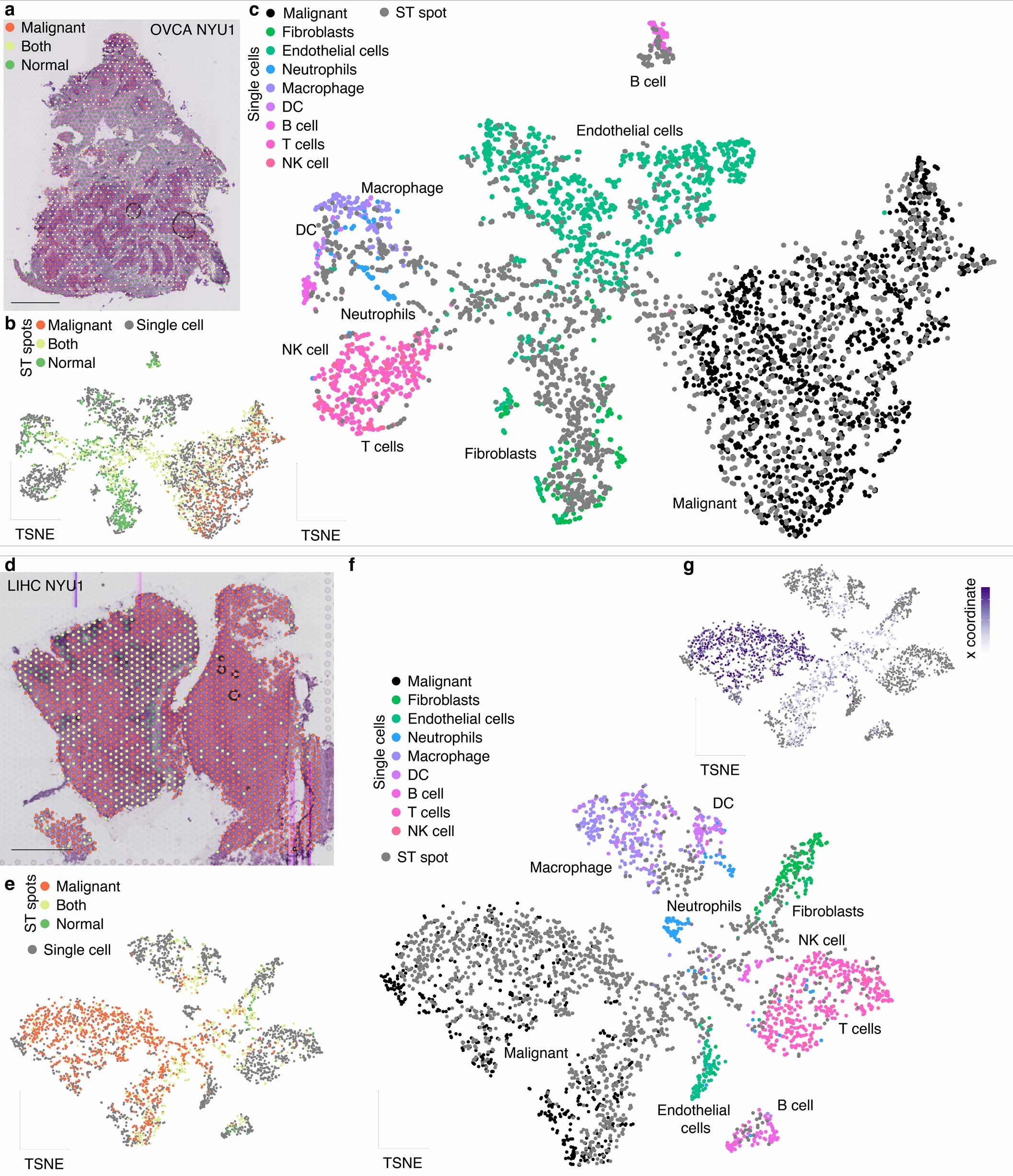 Extended Data Fig. 6: Spatial organization of the tumor microenvironment.
