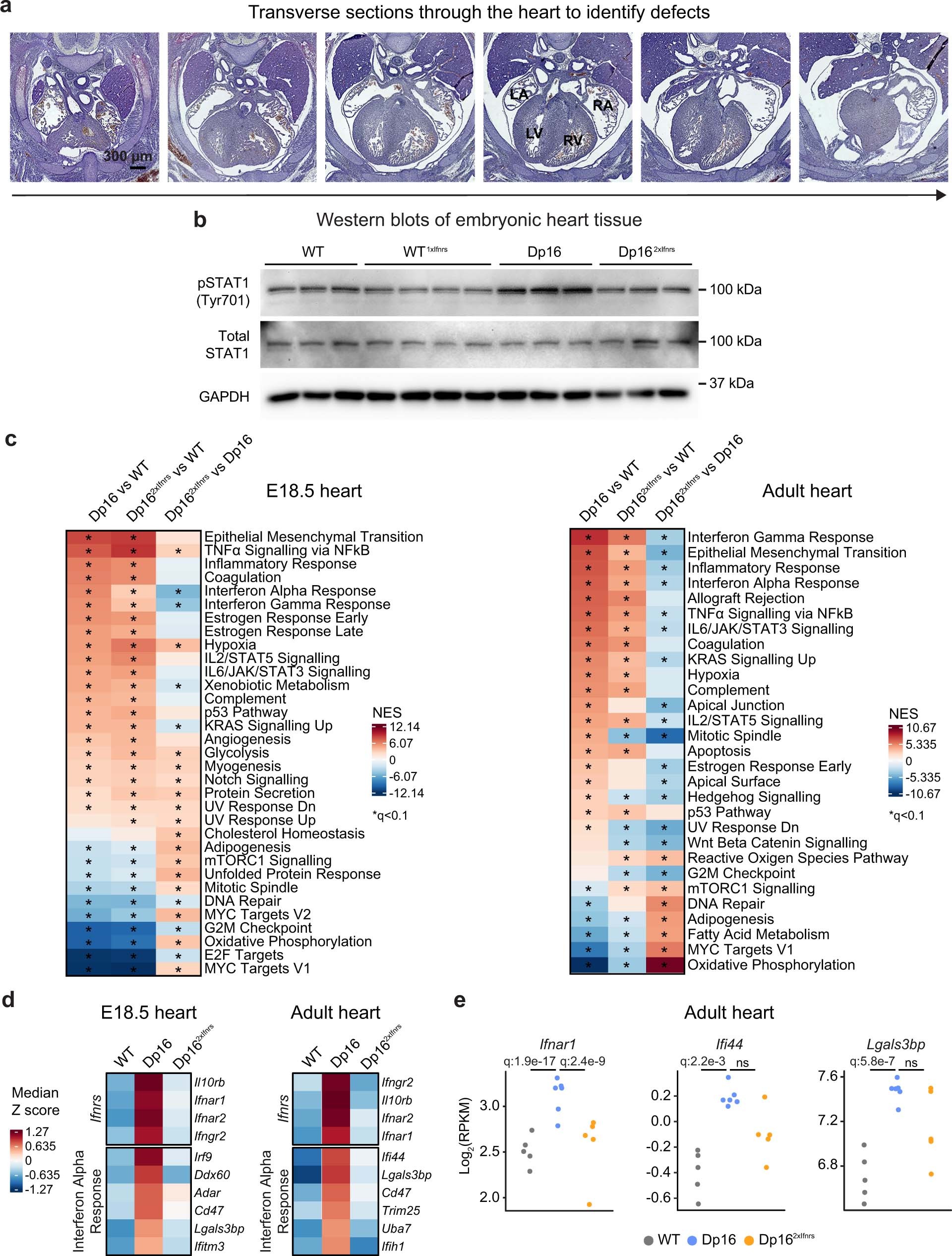 Extended Data Fig. 4: Correction of Ifnr locus copy number prevents embryonic heart malformations in a mouse model of Down syndrome.