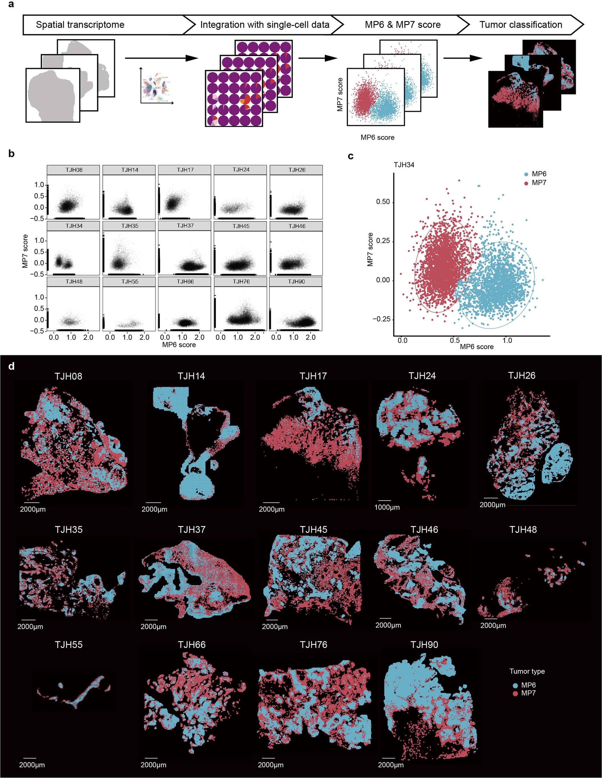 Extended Data Fig. 5: Identification of MP6 and MP7 tumor spots on spatial transcriptomics.