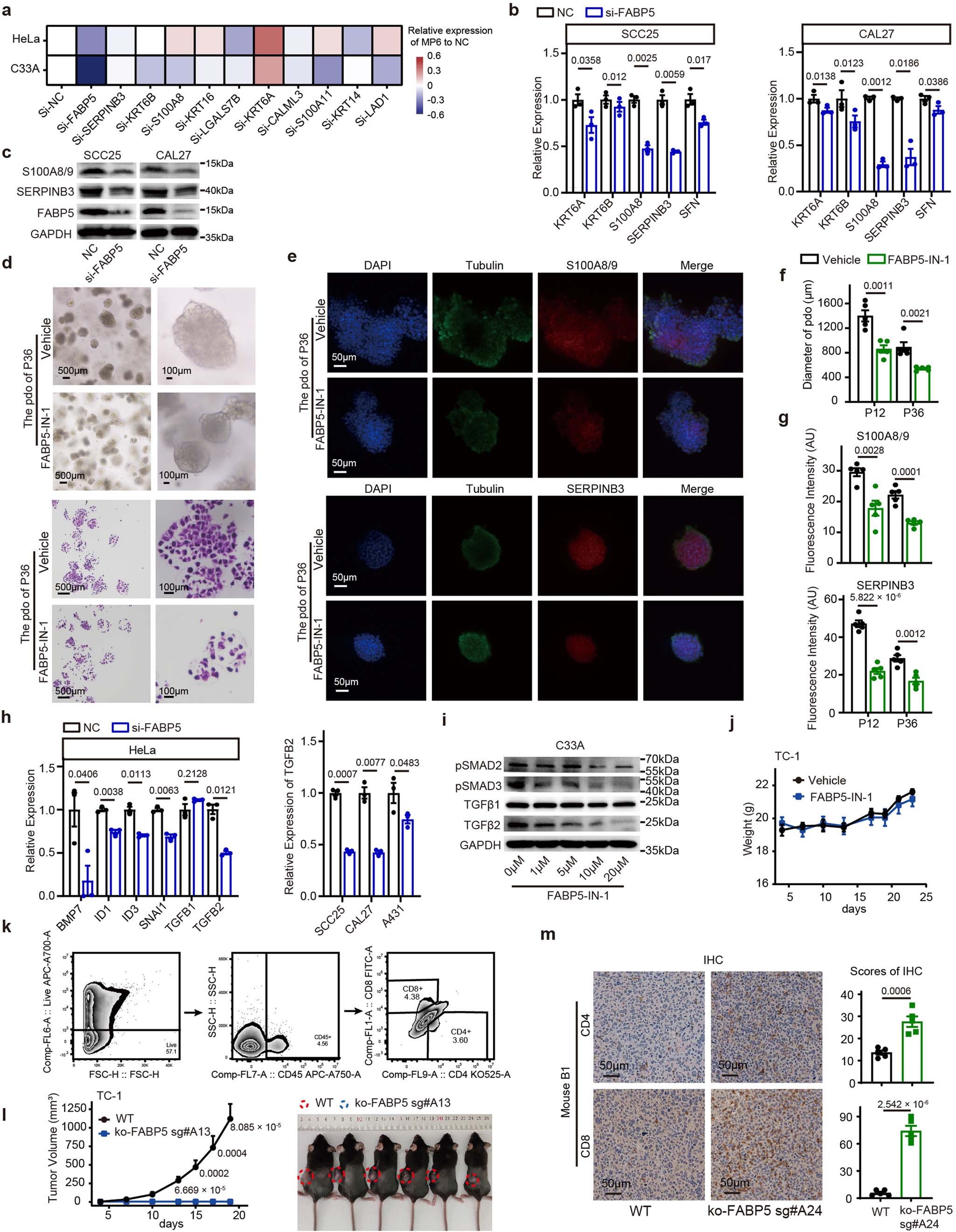 Extended Data Fig. 10: FABP5 is critical for MP6 state maintenance and contributed to the activated TGFβ and interaction with immunosuppressive CAF.