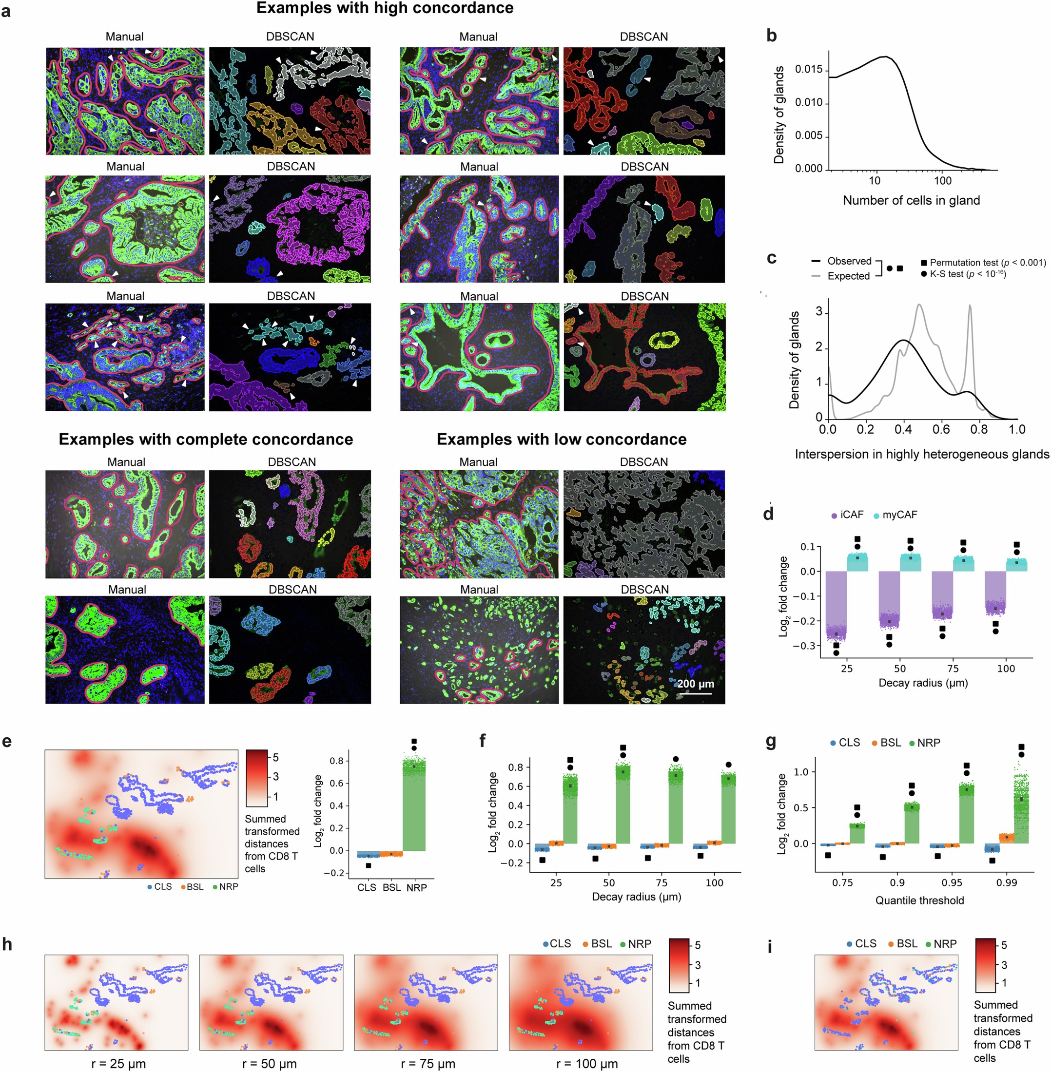 Extended Data Fig. 4: Glandular heterogeneity and multicellular neighborhoods in pancreatic cancer.