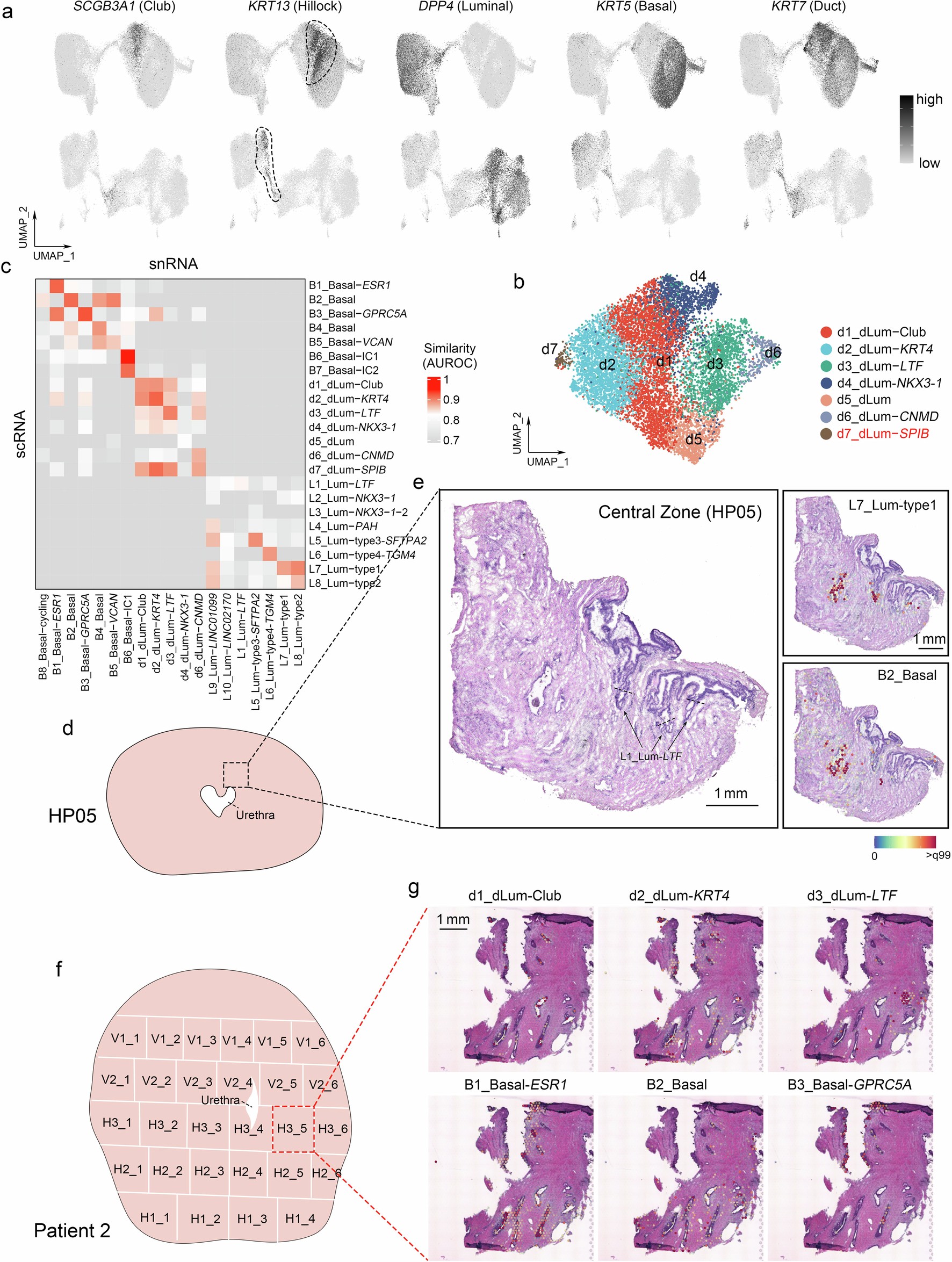 Extended Data Fig. 1: Identification of subpopulations of ductal luminal (dLum) and basal cells in human prostate.